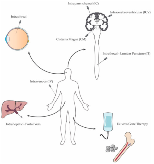 Gene therapy shows promise for treating Niemann-Pick disease type C1