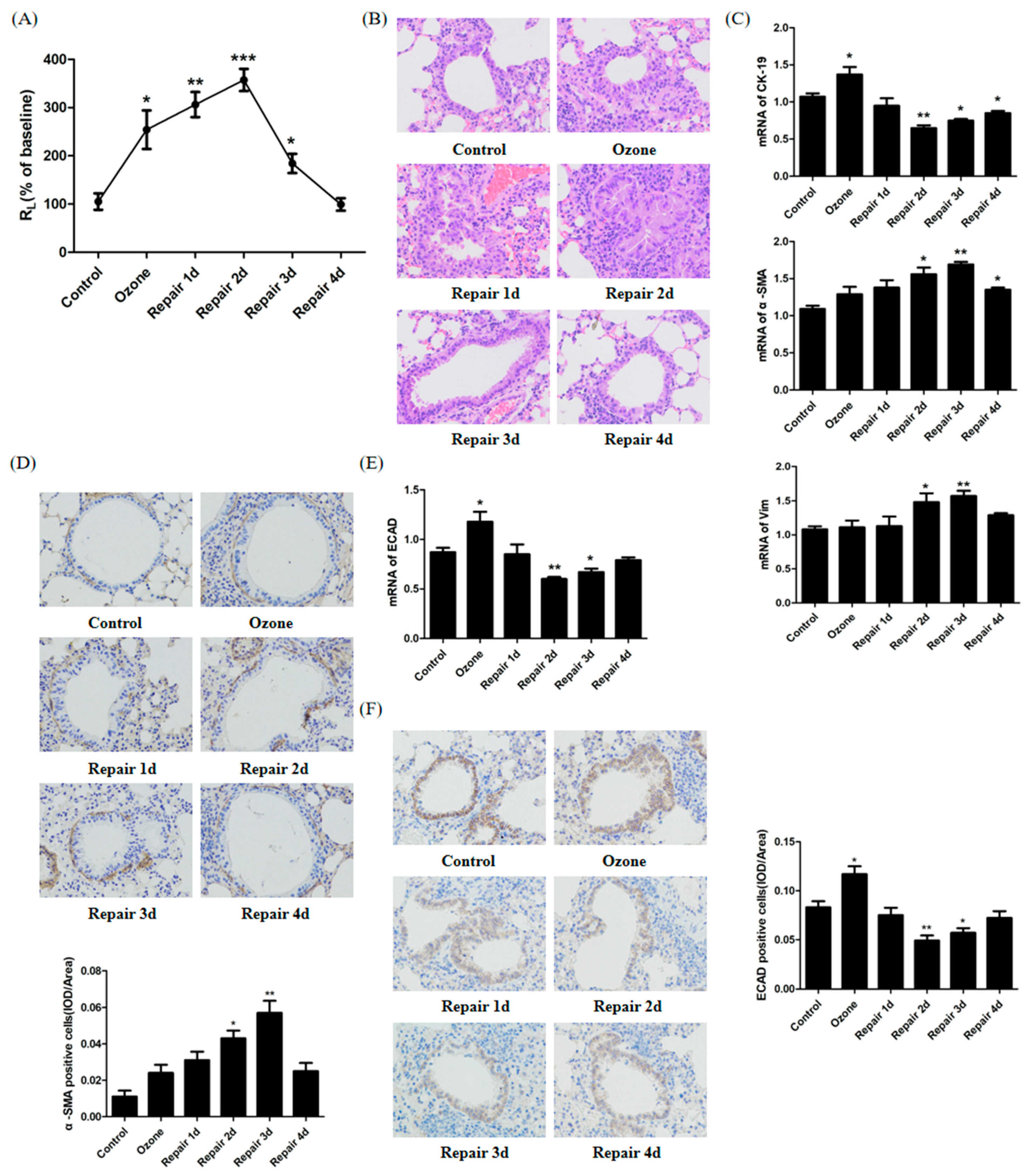 Biomolecules Free Full Text Modulation Of The Emt Met Process By E Cadherin In Airway Epithelia Stress Injury Html
