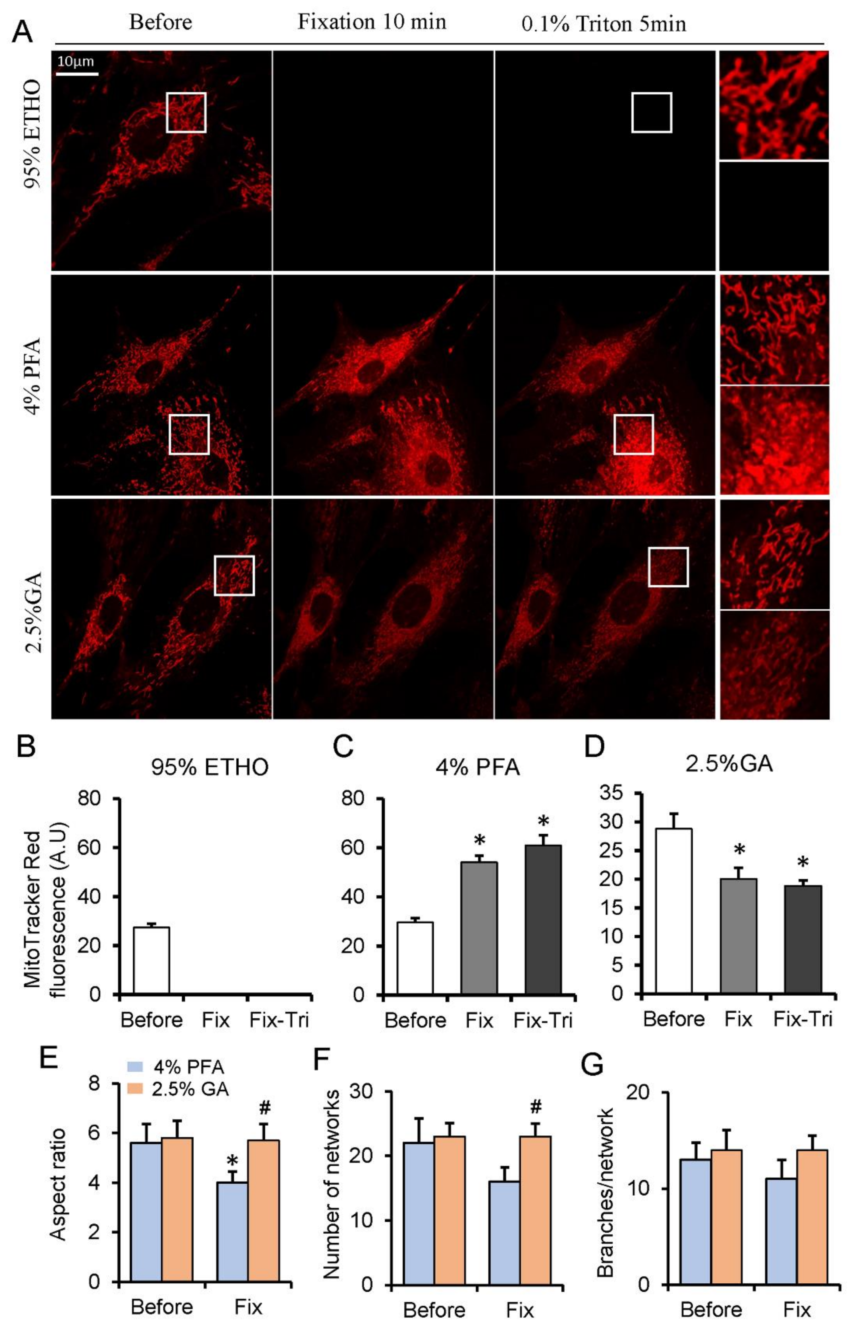 Biomolecules Free Full Text The Combination Of Paraformaldehyde And Glutaraldehyde Is A Potential Fixative For Mitochondria Html