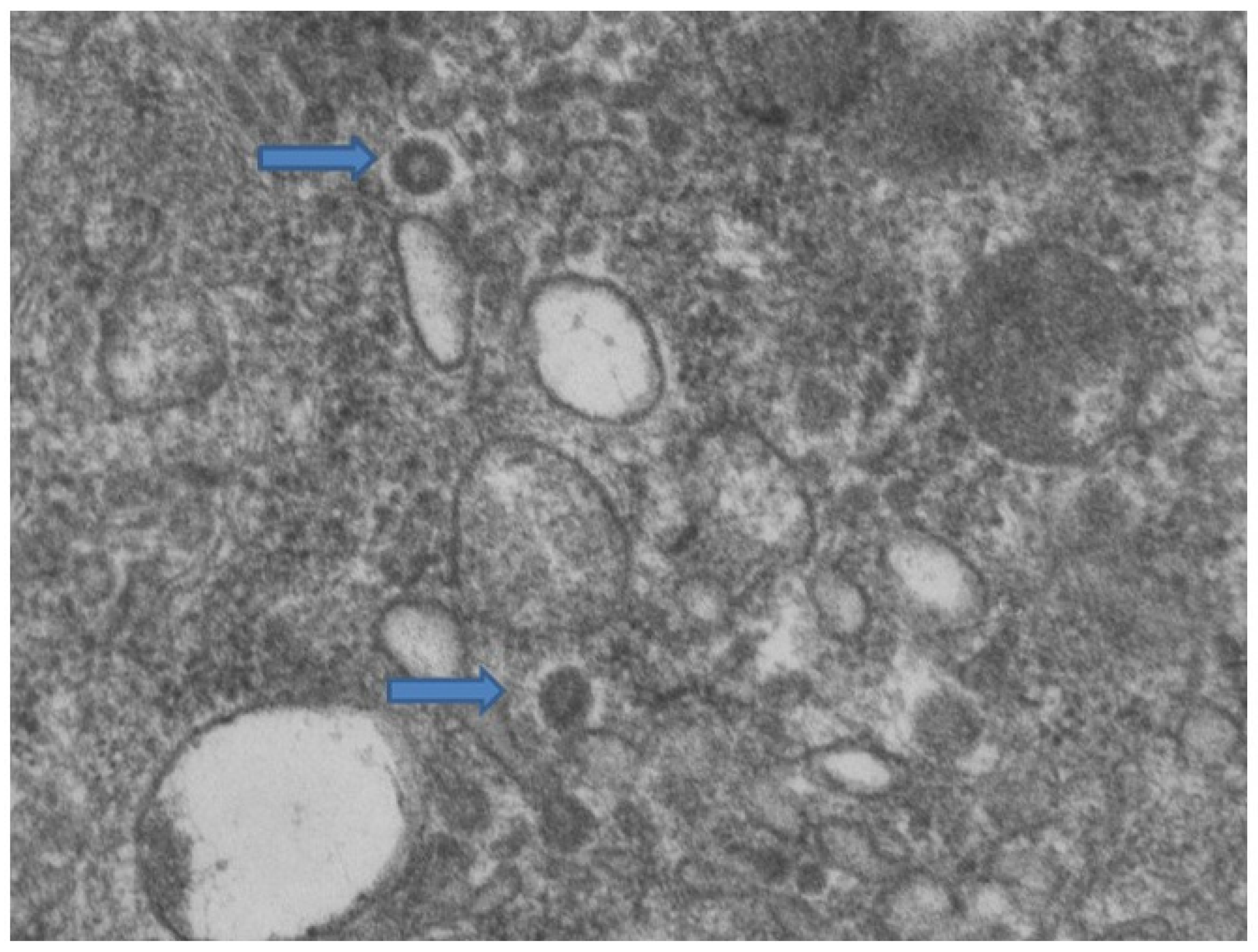 Biomolecules 11 00838 g004