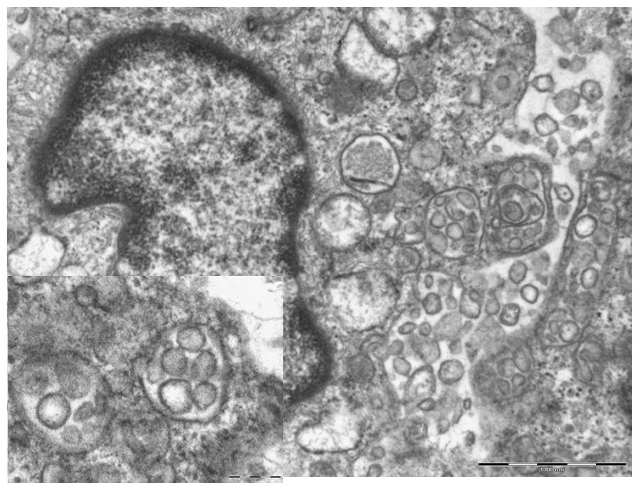 Biomolecules 11 00838 g008
