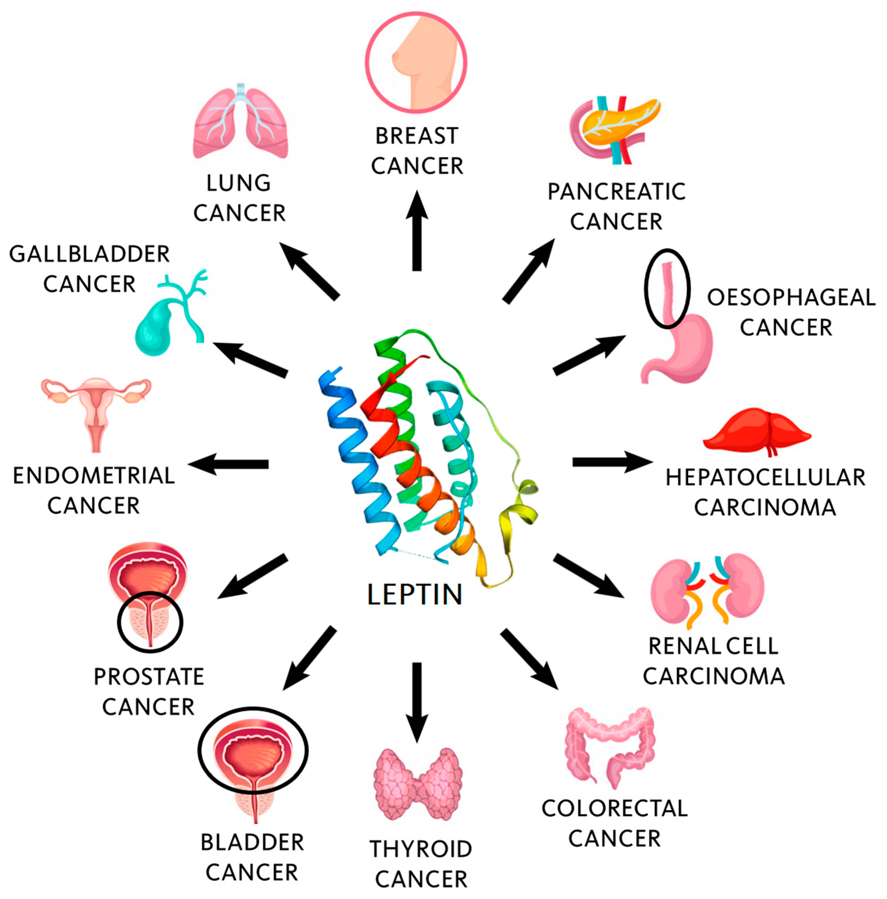 Leptin, Both Bad and Good Actor in Cancer