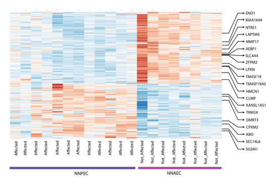 Let's Go 1, 2, 3 セット CO-Z Automatic Dual Swing Gate Opener Kit, Electric Gate