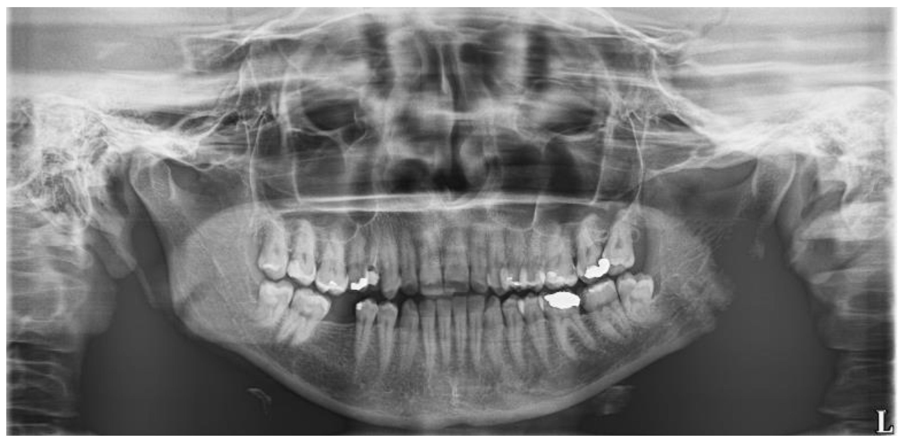 Biomolecules 11 01157 g003