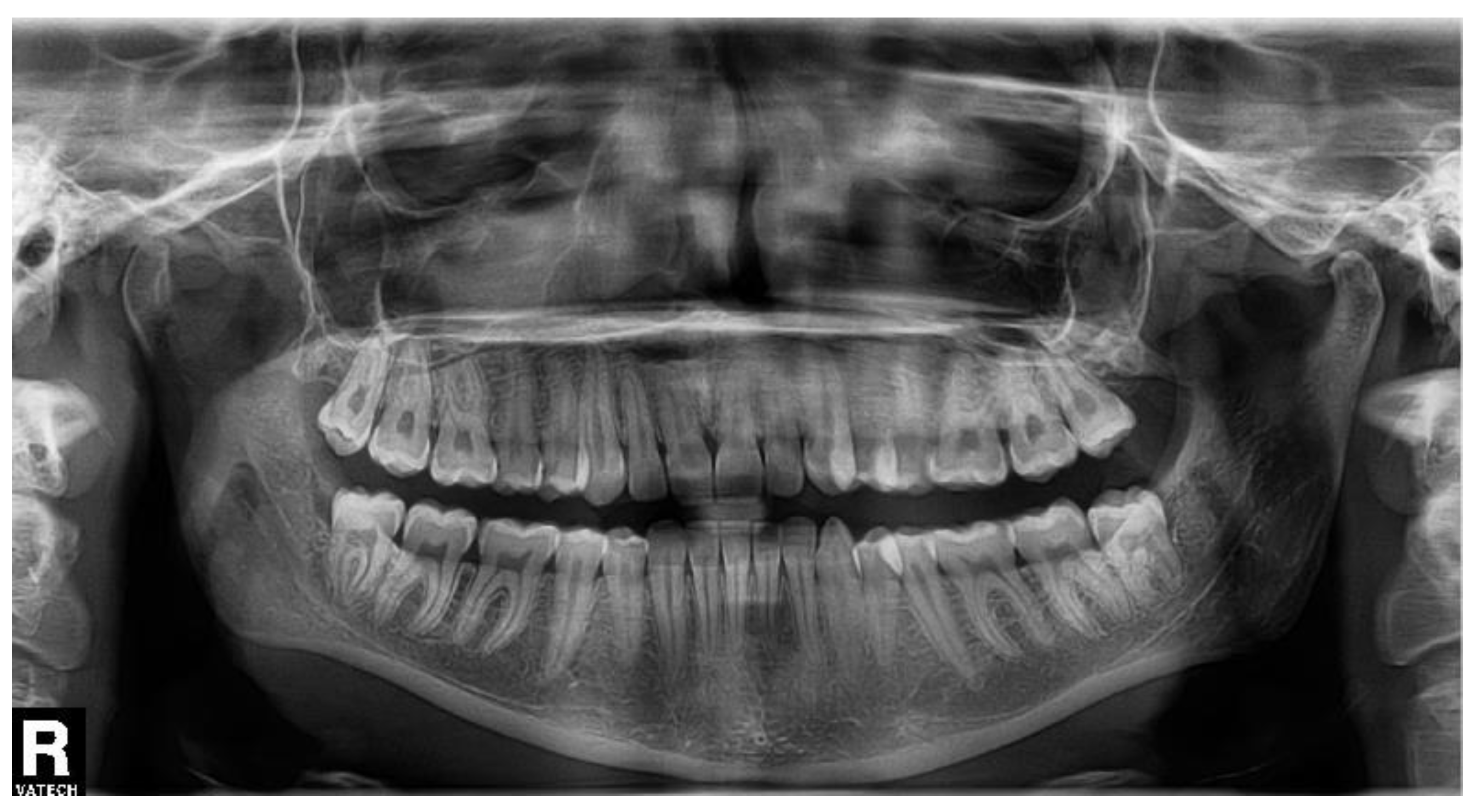 Biomolecules 11 01157 g004