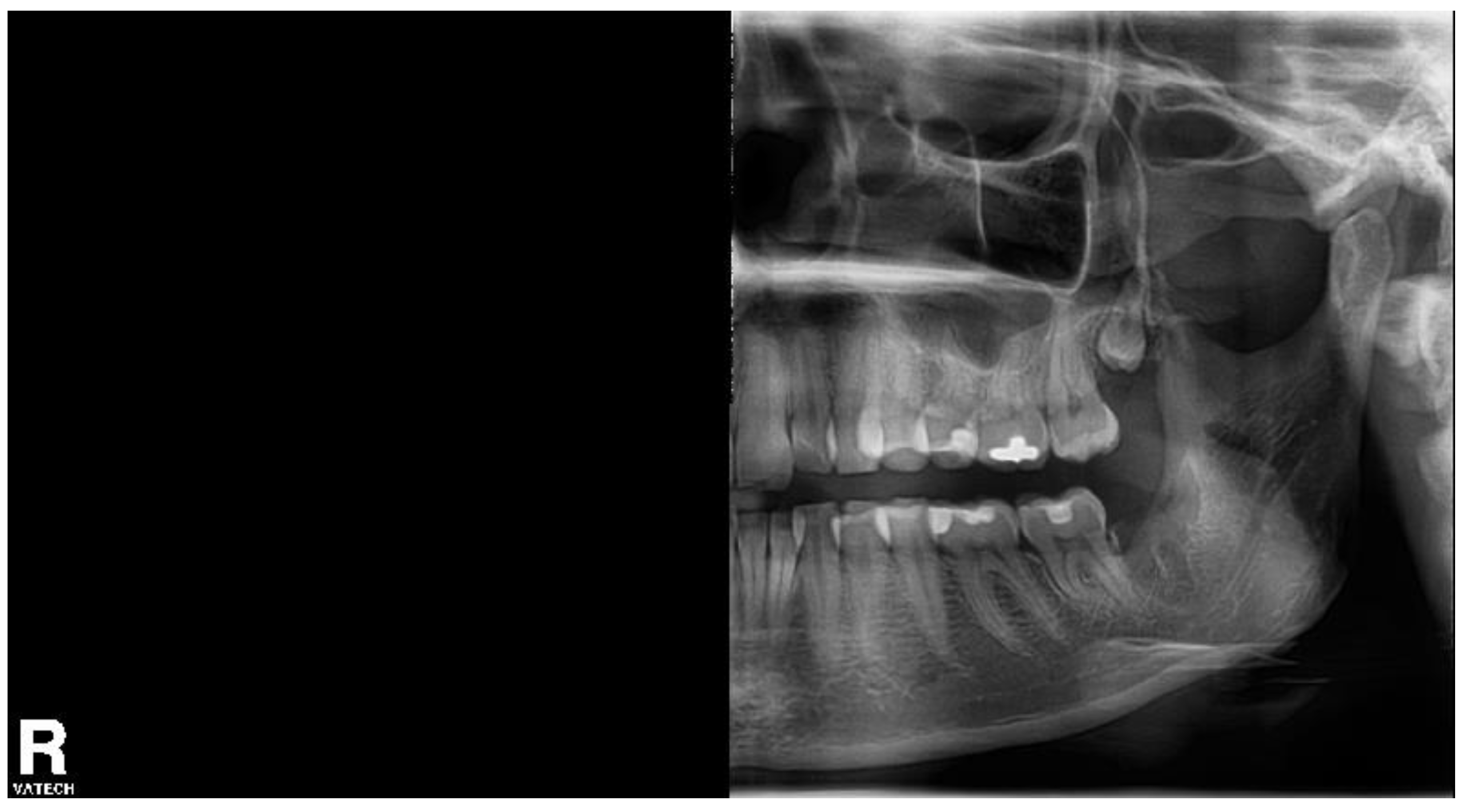 Biomolecules 11 01157 g006