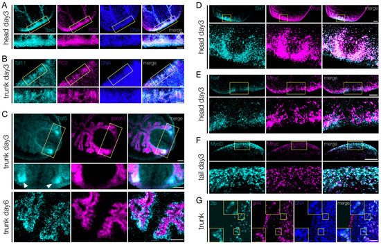 Context Matters: NOTCH Signatures and Pathway in Cancer Progression and  Metastasis