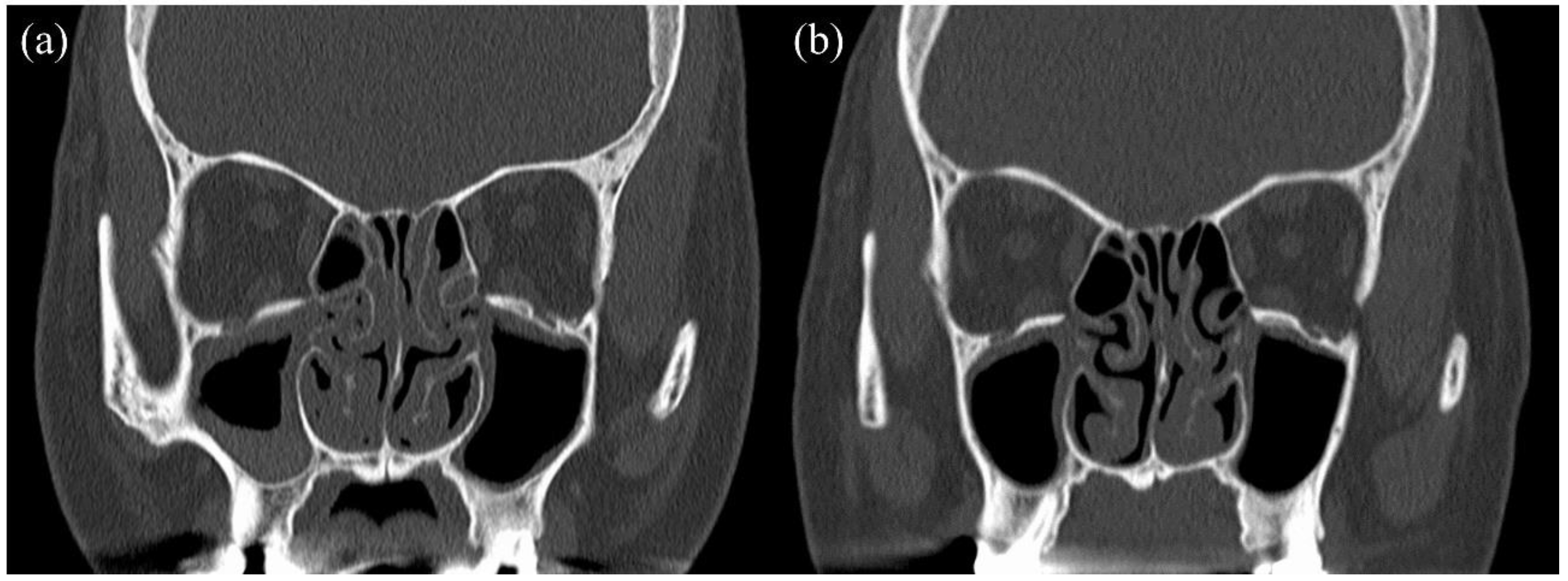 Biomolecules 12 00522 g002 550