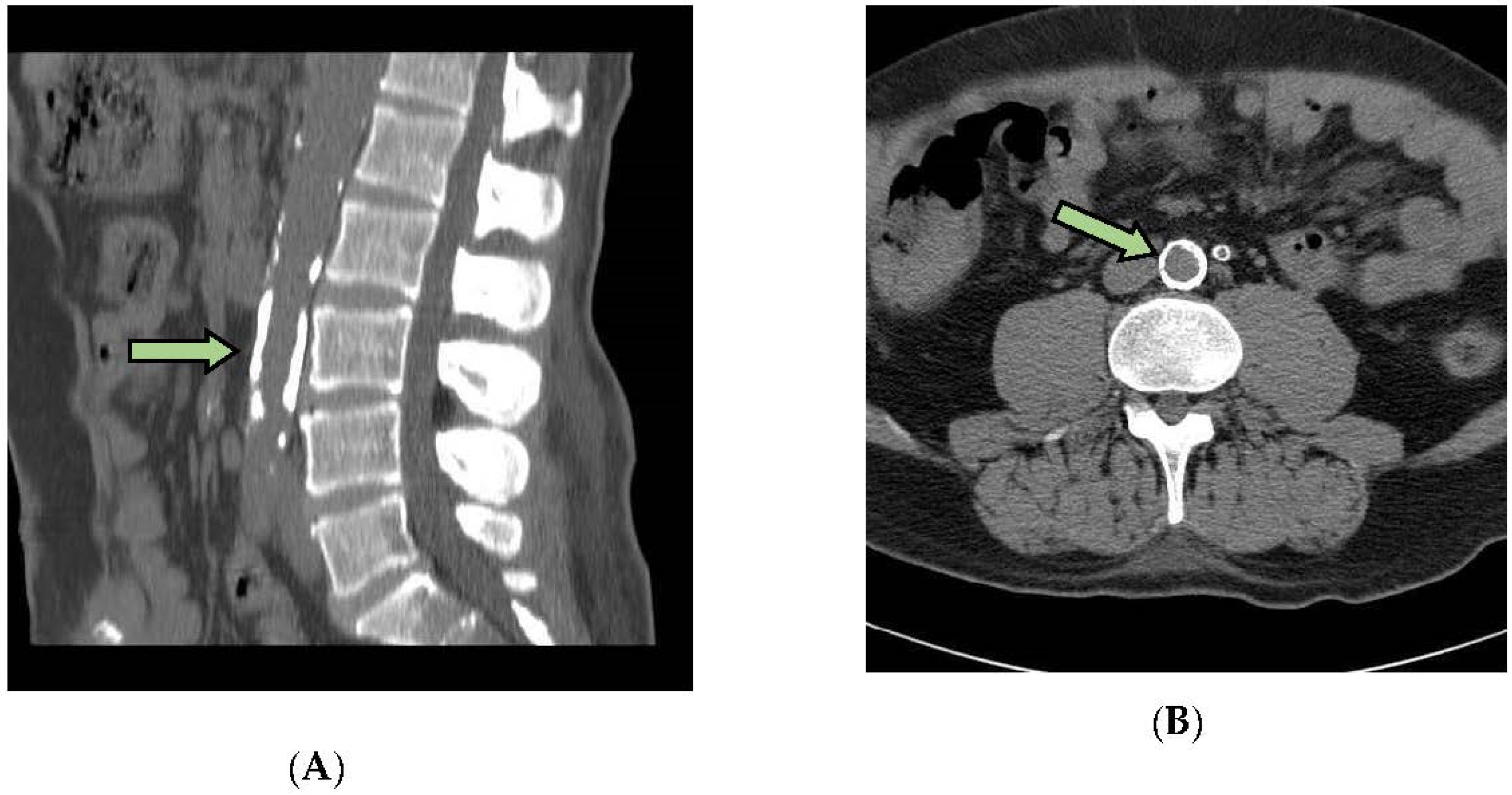 Biomolecules 12 00551 sch001 Biomolecules 12 00551 sch001