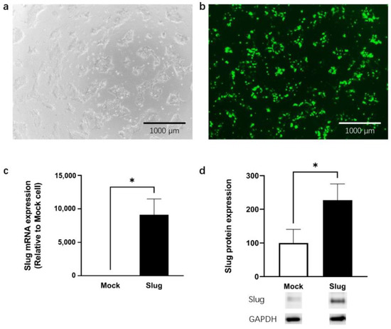 Slug Mediates MRP2 Expression in Non-Small Cell Lung Cancer