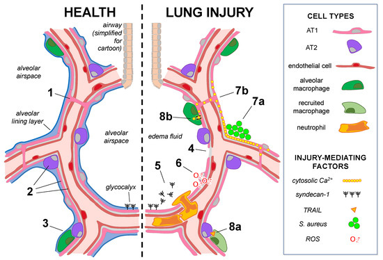 Complex urban atmosphere alters alveolar stem cells niche properties and  drives lung fibrosis