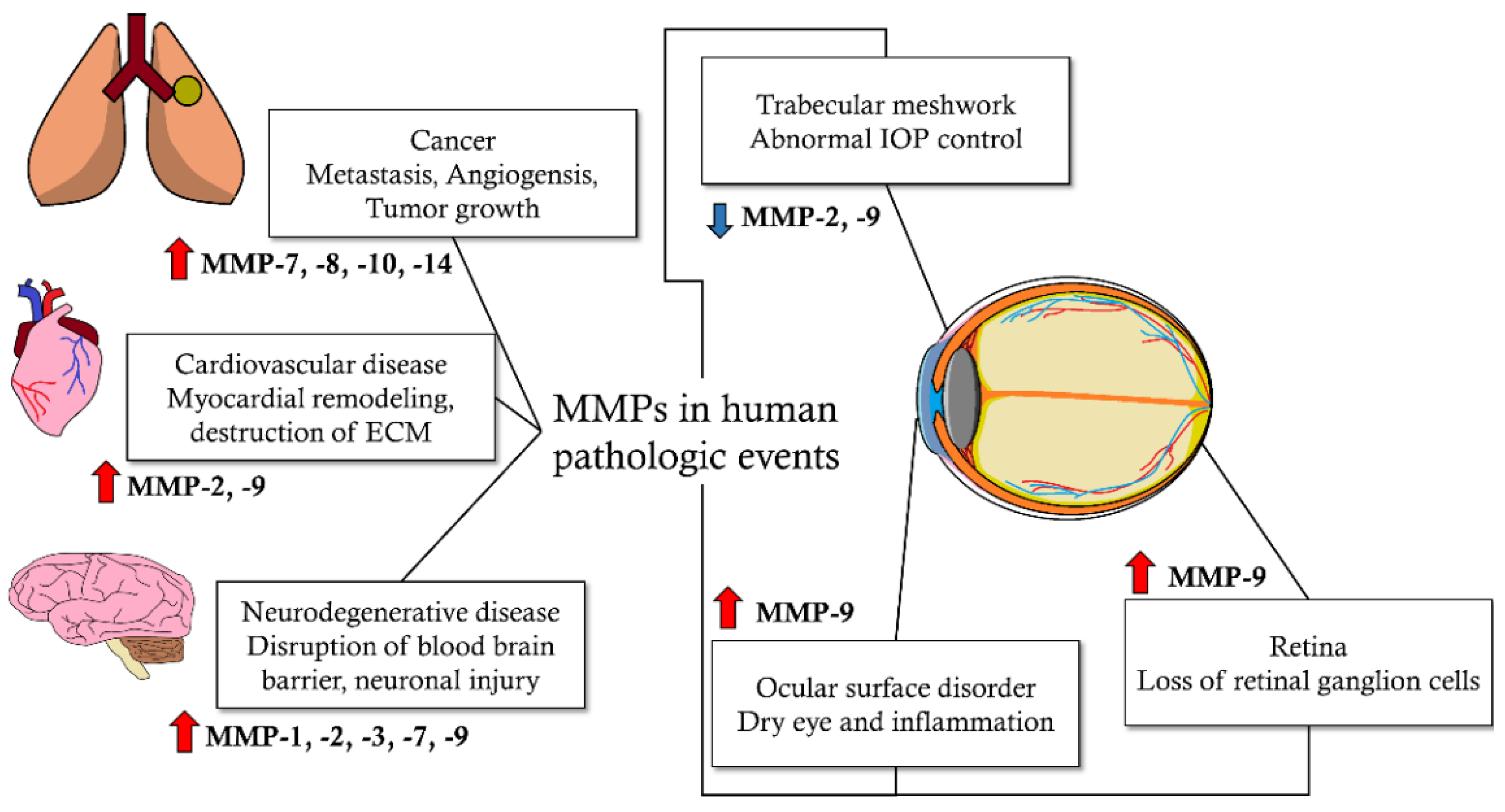 Biomolecules Free Full-Text Matrix Metalloproteinases and Glaucoma