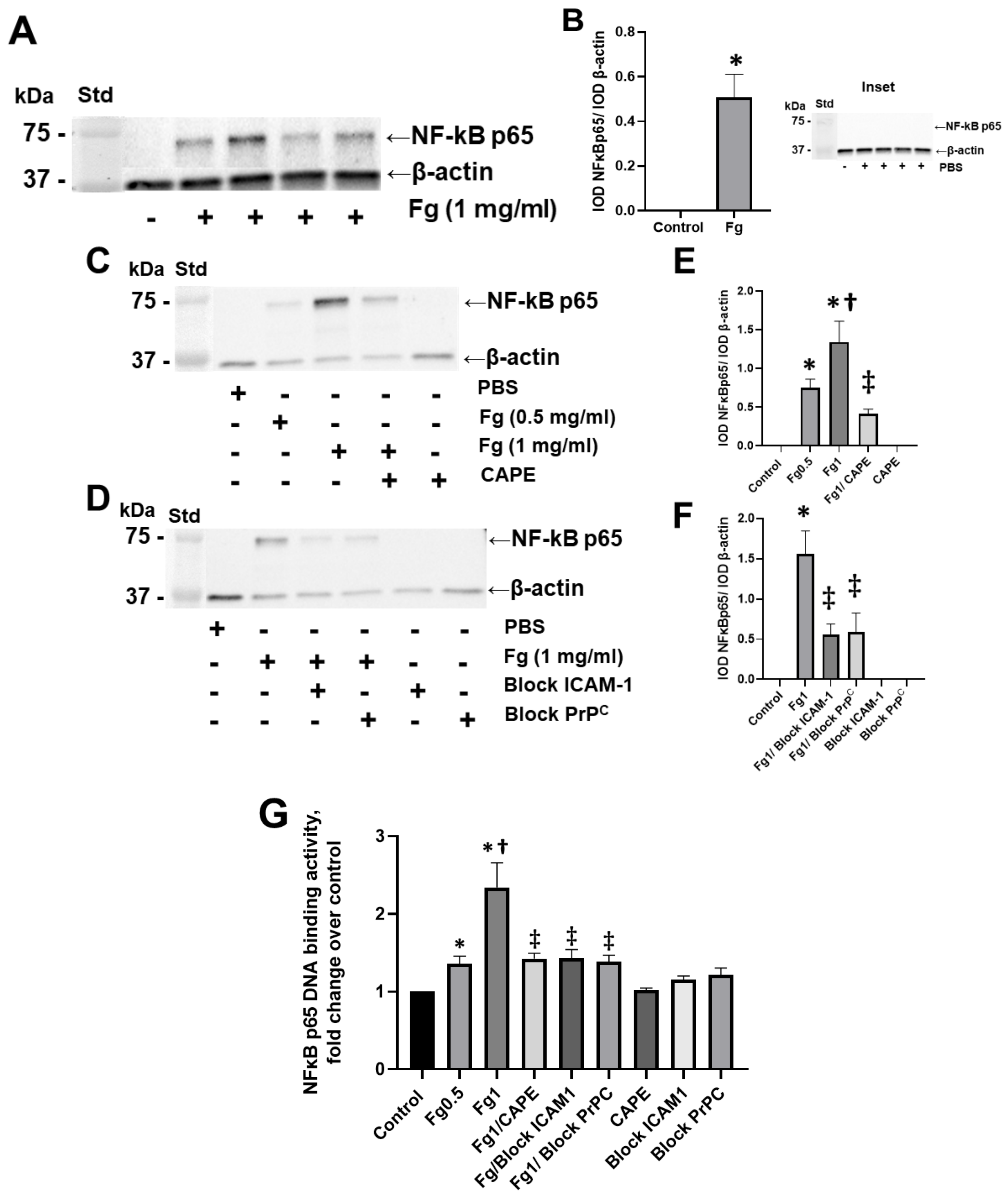 Western blots show p65 antibodies that passed the test of specificity