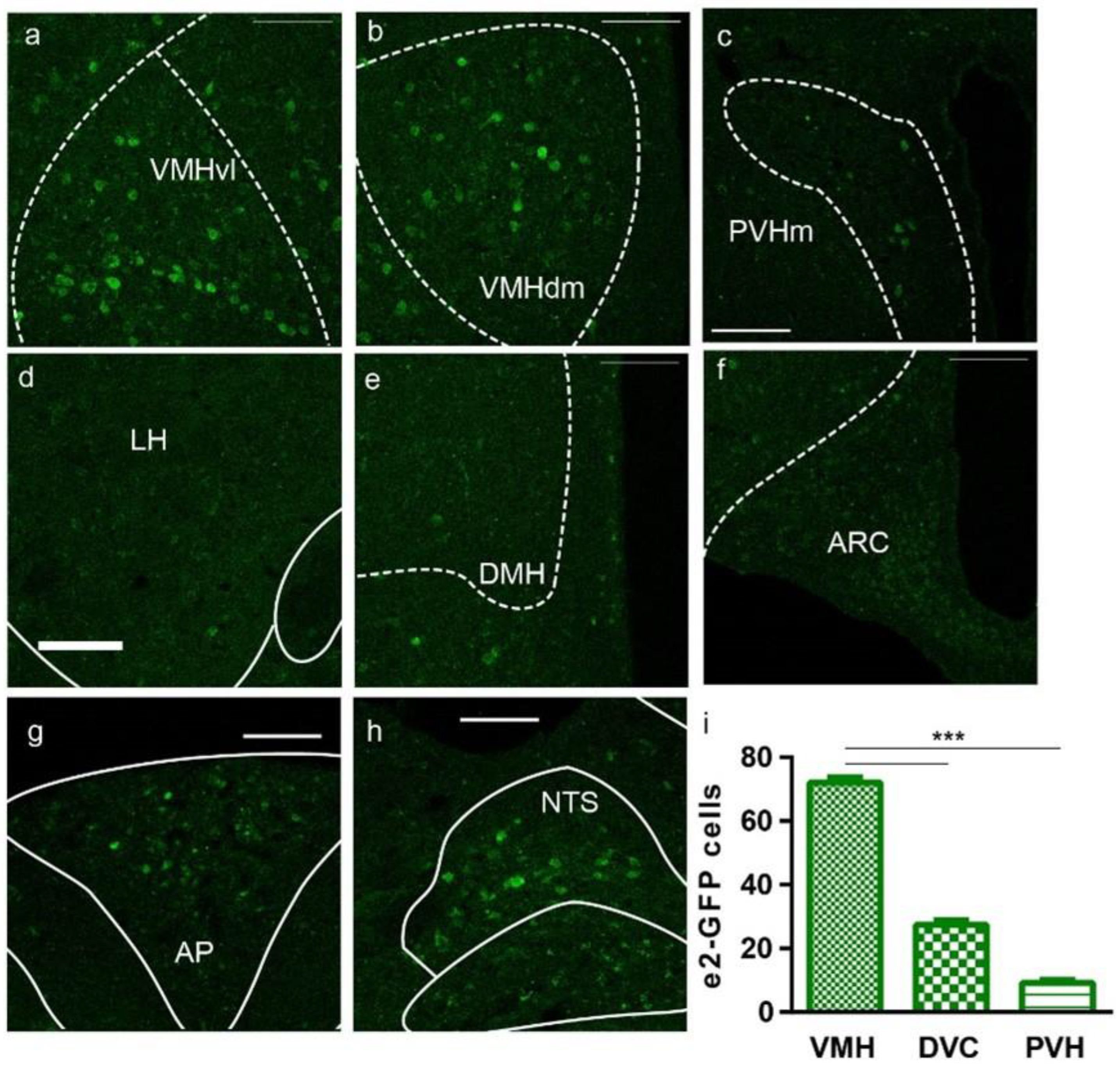 TrkB-expressing paraventricular hypothalamic neurons suppress appetite  through multiple neurocircuits