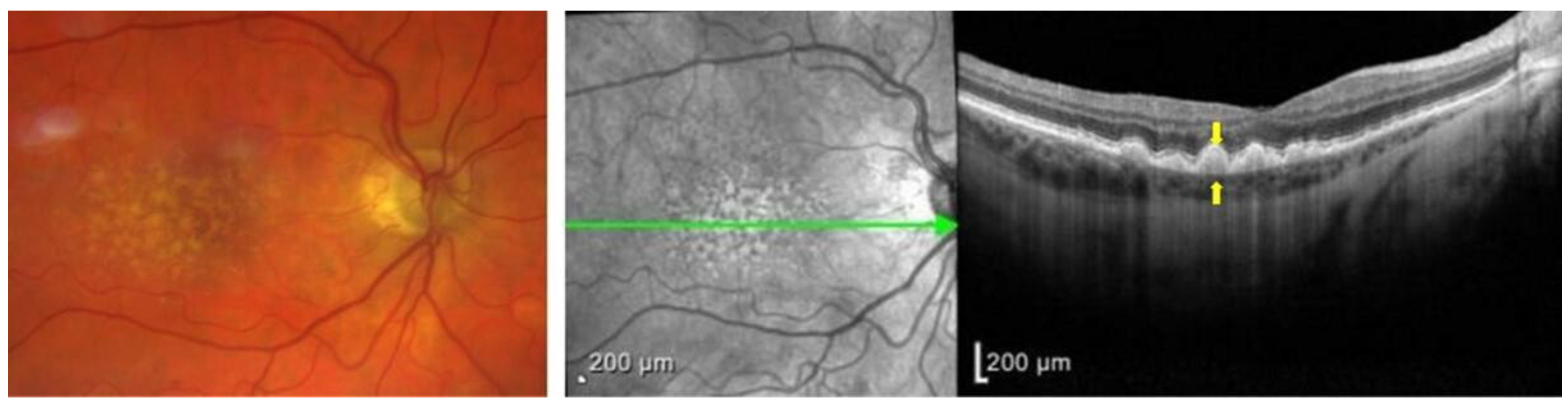 Biomolecules 13 00832 g002 Biomolecules 13 00832 g002