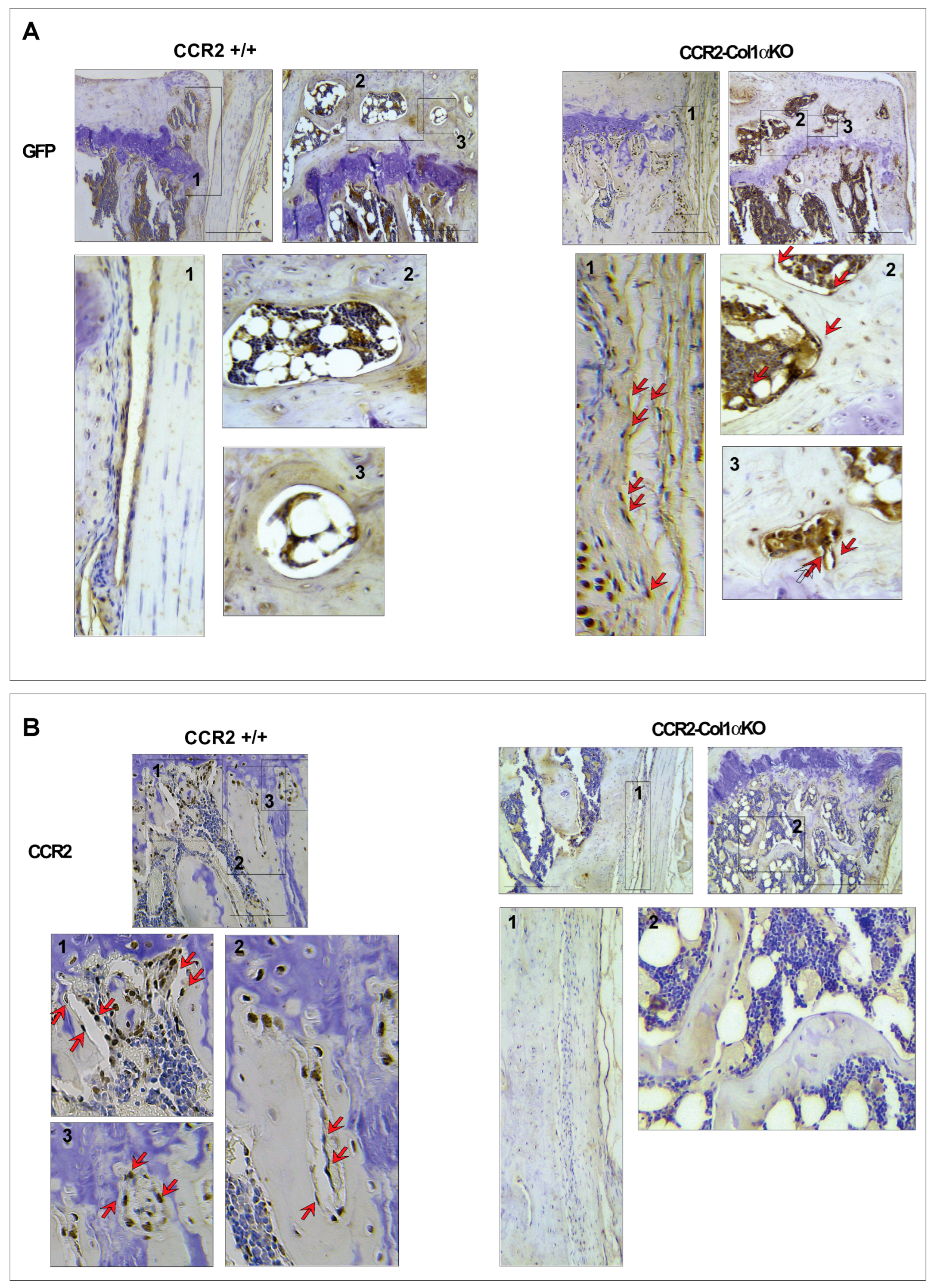 CC-Chemokine Receptor-2 Expression in Osteoblasts
