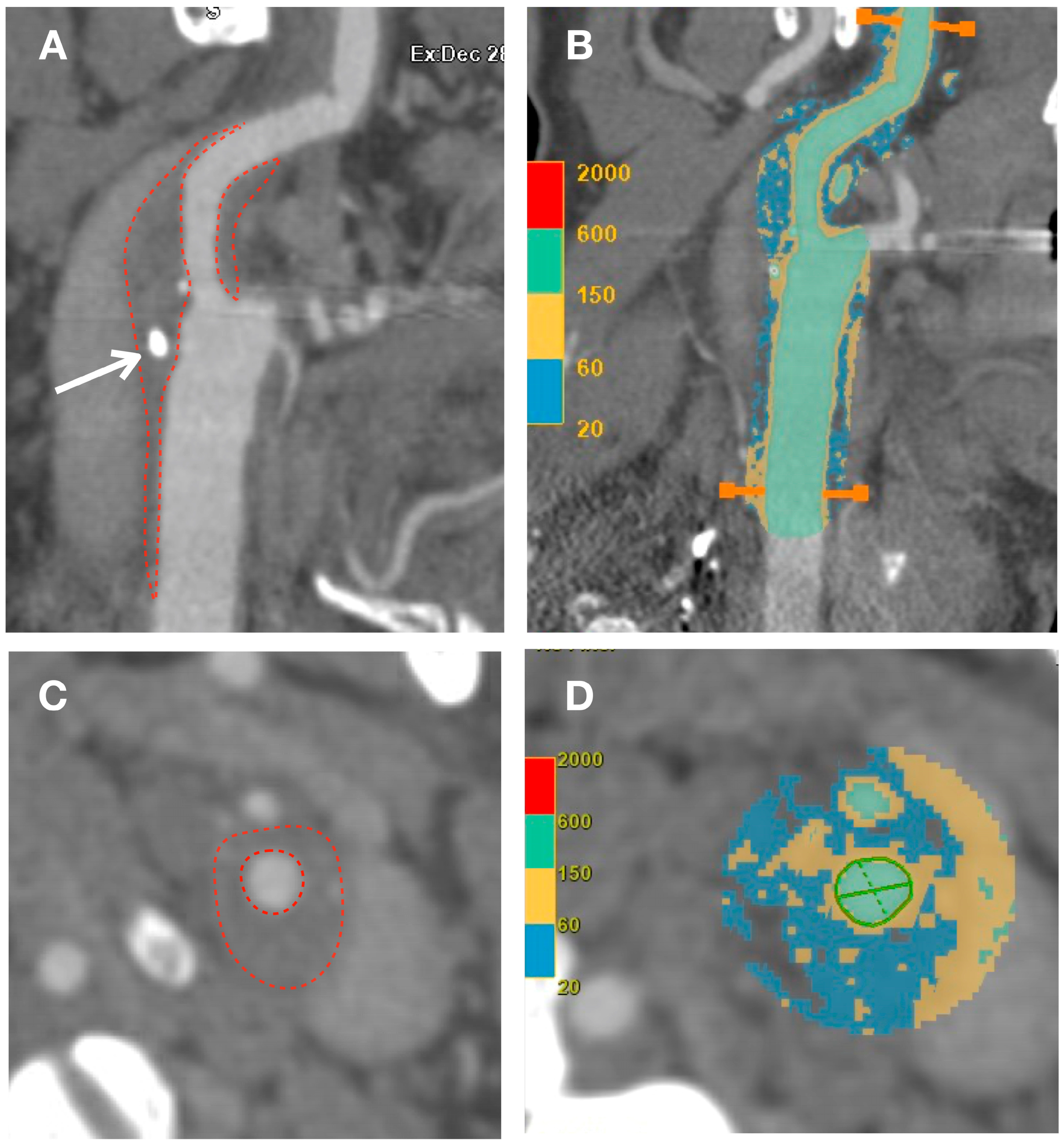 Biomolecules 13 01236 g005