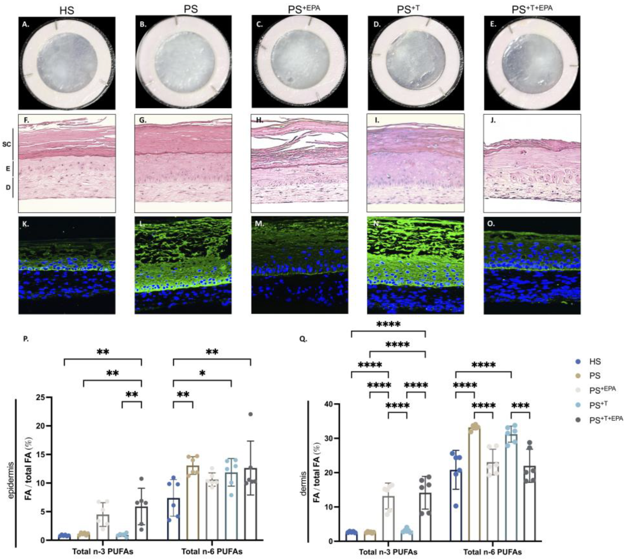 Eicosapentaenoic Acid Influences the Lipid Profile of an In