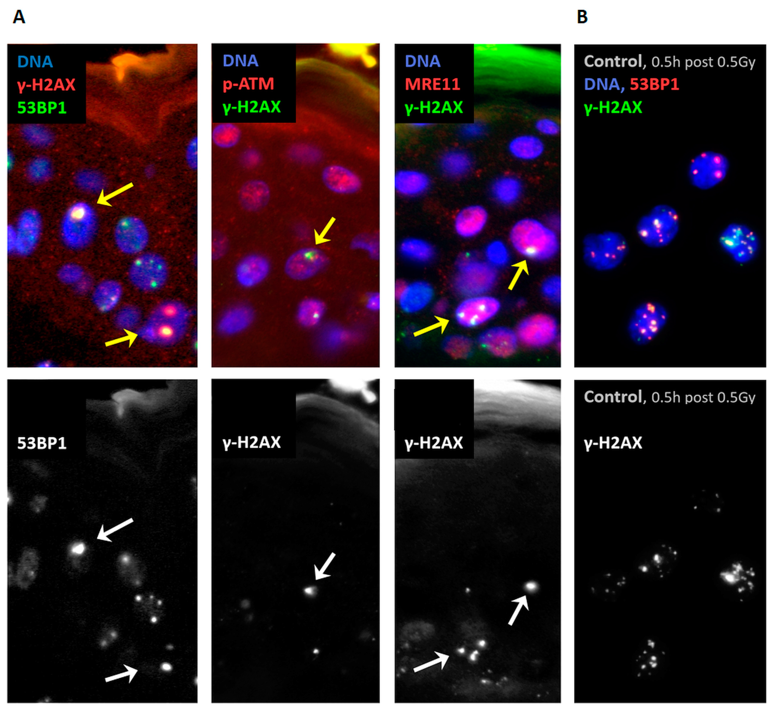 Nano-Architecture of Persistent Focal DNA Damage Regions in