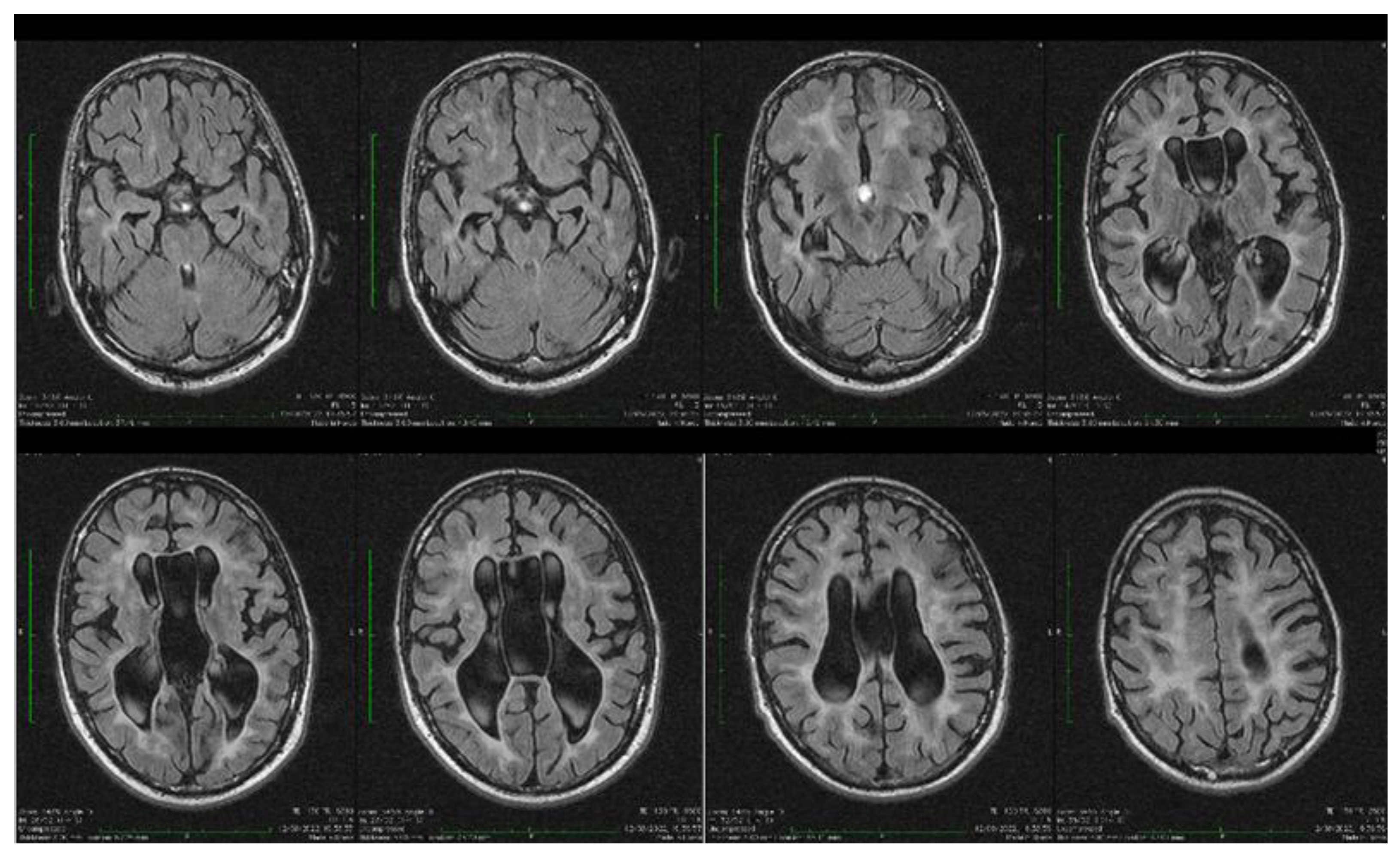 Biomolecules 14 00270 g004