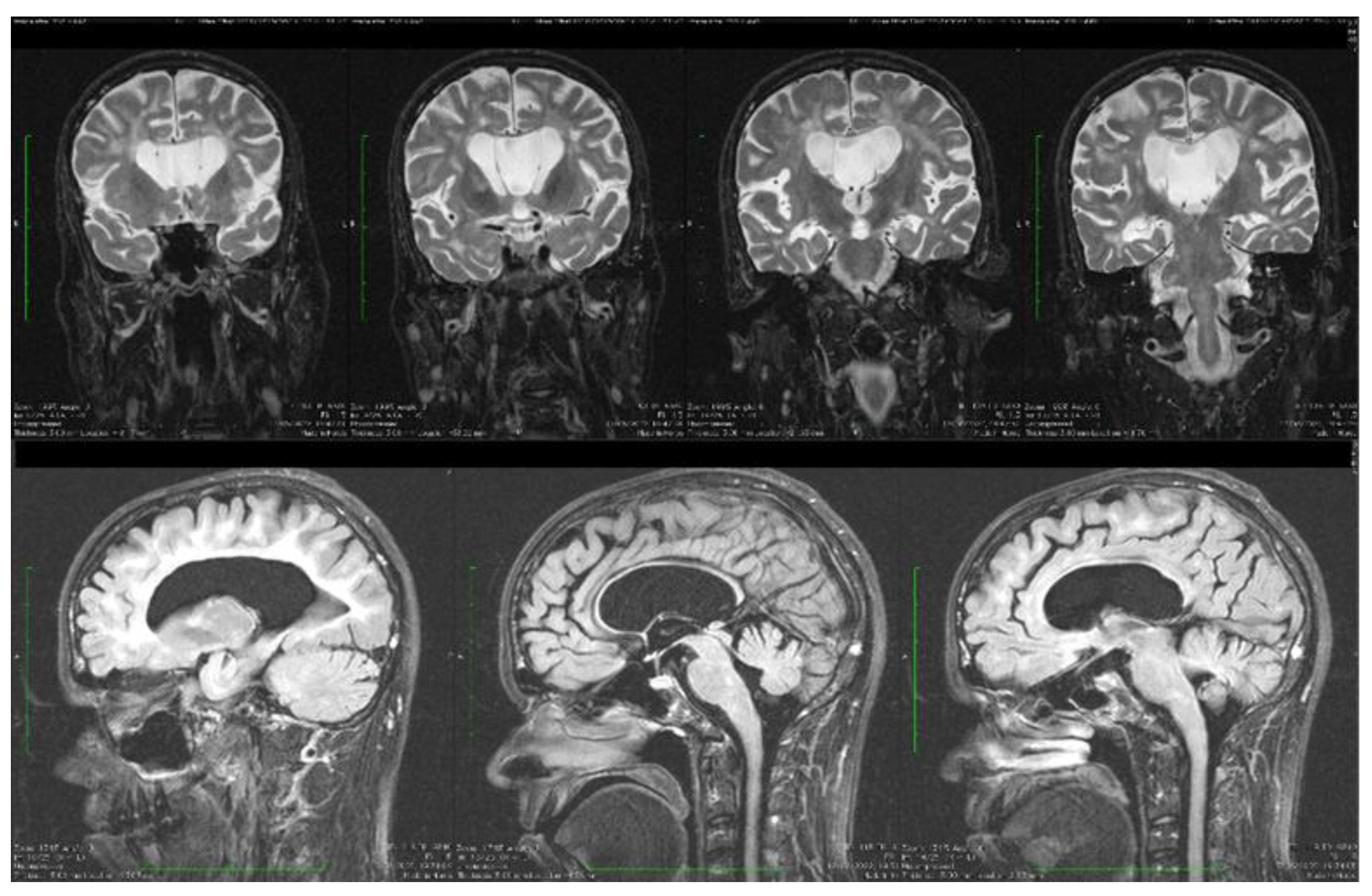 Biomolecules 14 00270 g005