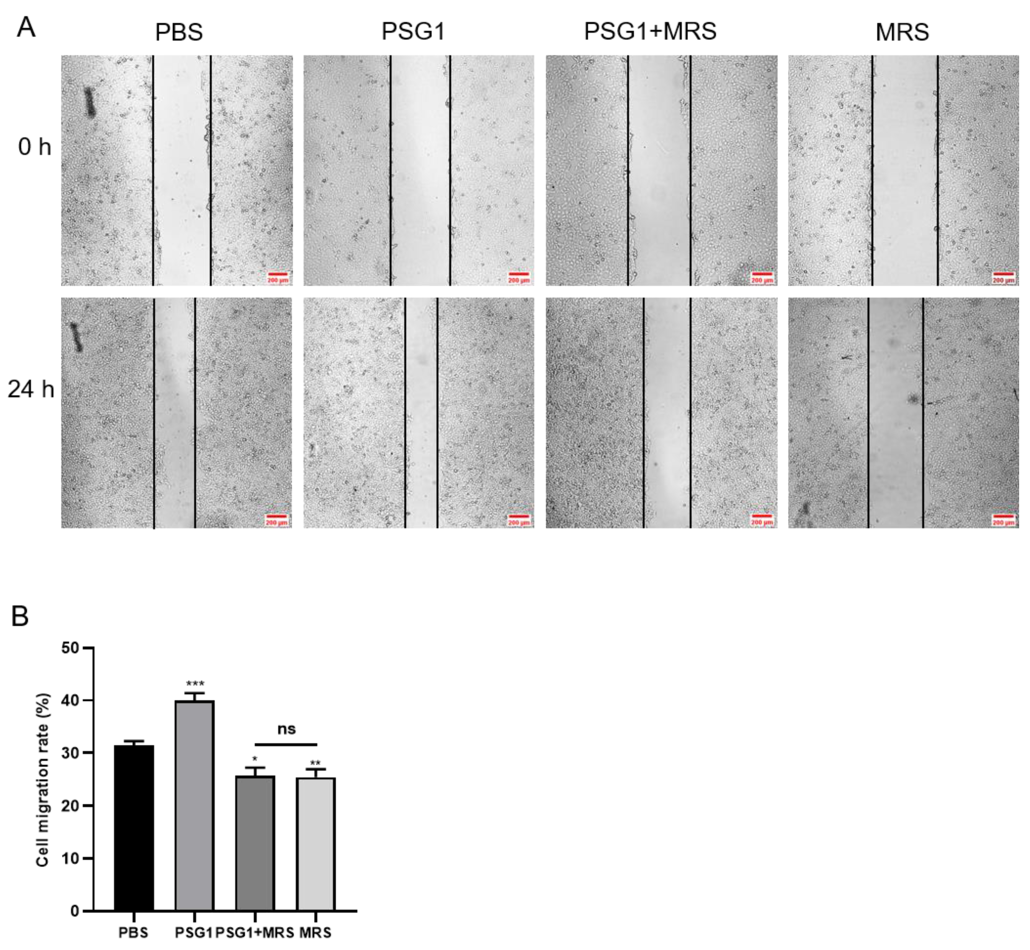 Biomolecules 14 00293 g005