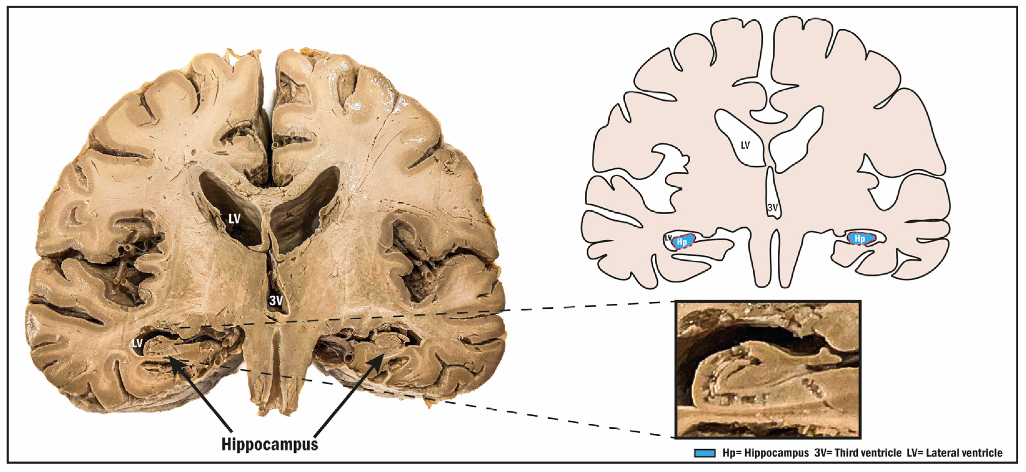 Biomolecules 14 00335 g002 Biomolecules 14 00335 g002