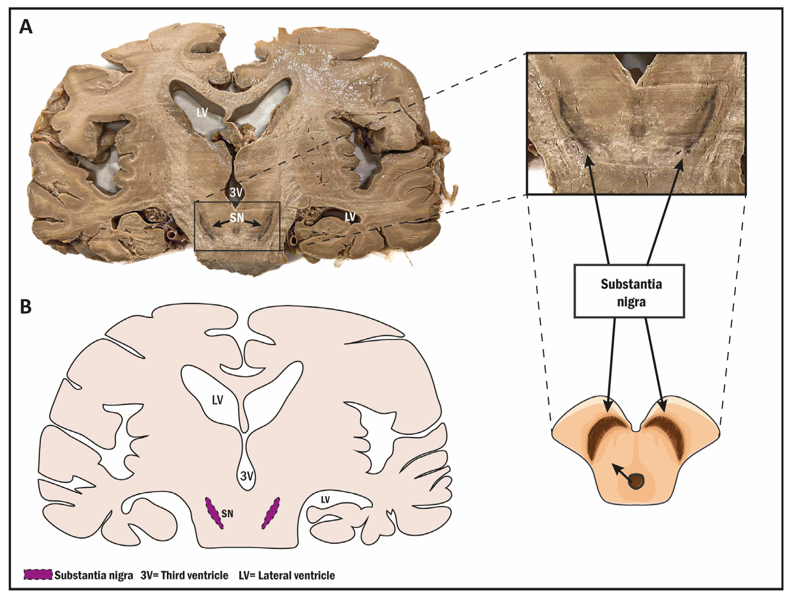 Biomolecules 14 00335 g005 Biomolecules 14 00335 g005
