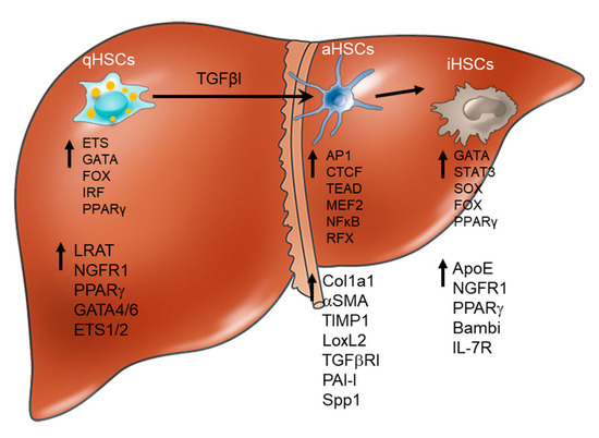 Alcohol-Associated Liver Disease Outcomes: Critical