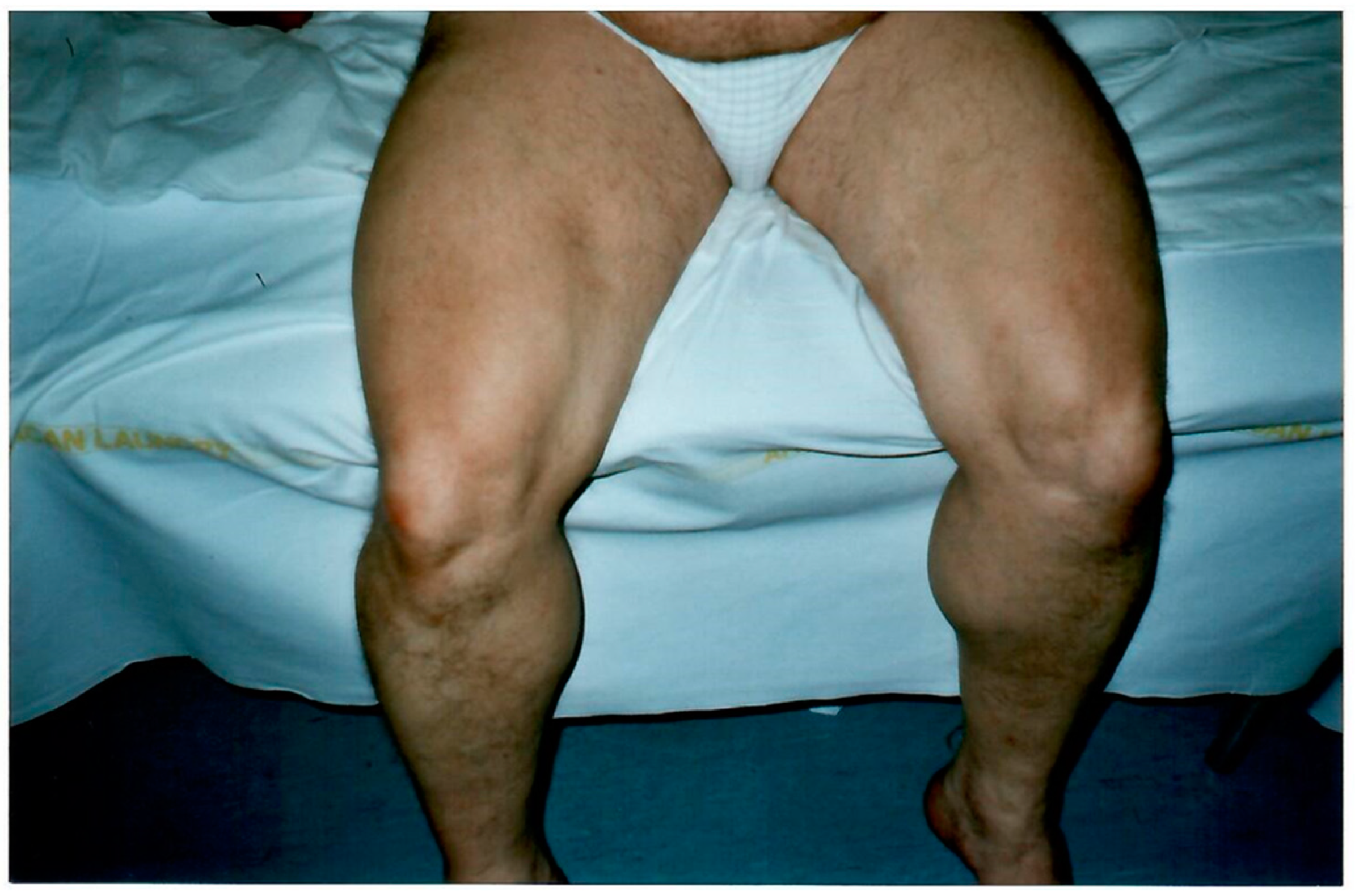 Biomolecules 14 00507 g003 Biomolecules 14 00507 g003