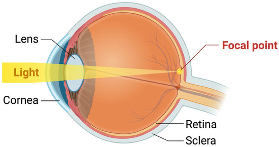 Oxidative Stress and Cataract Formation: Evaluating the