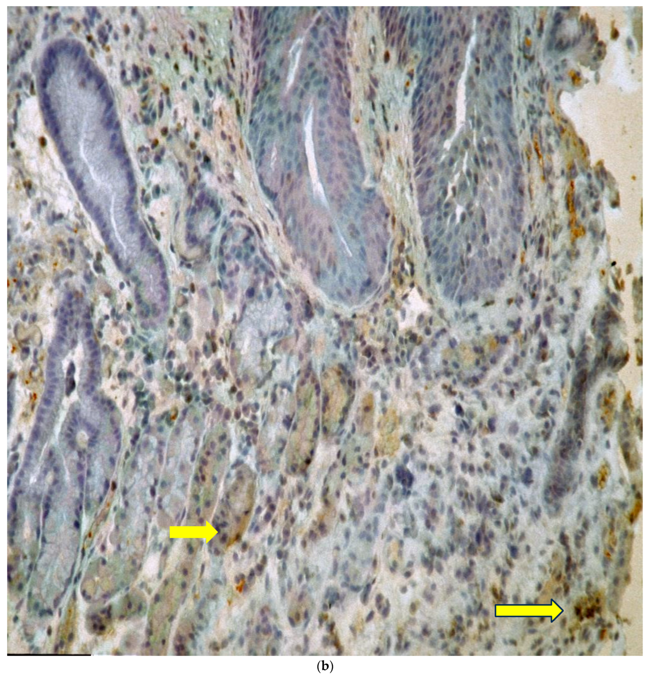 Biomolecules 14 01182 g002b