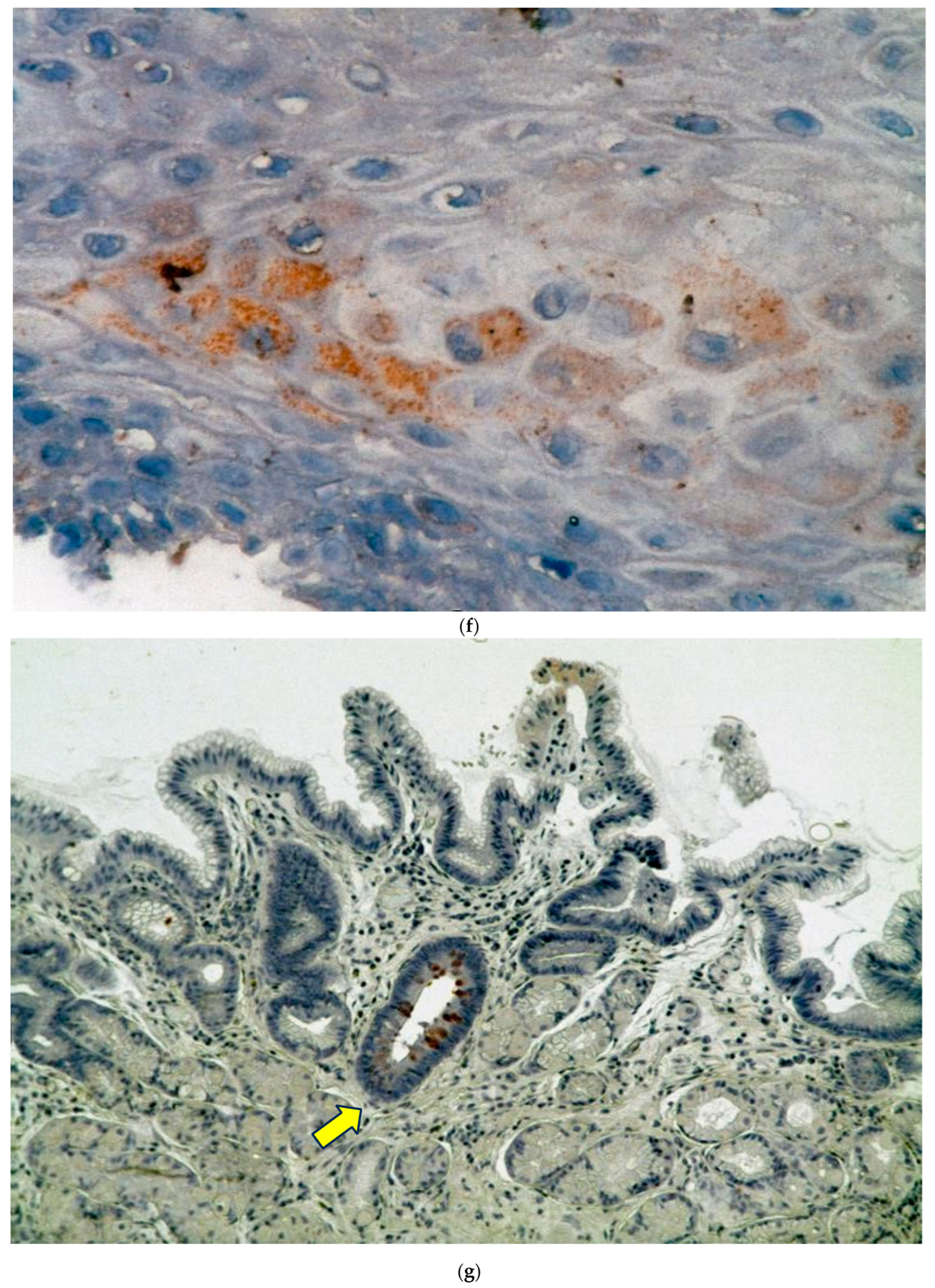 Biomolecules 14 01182 g002e