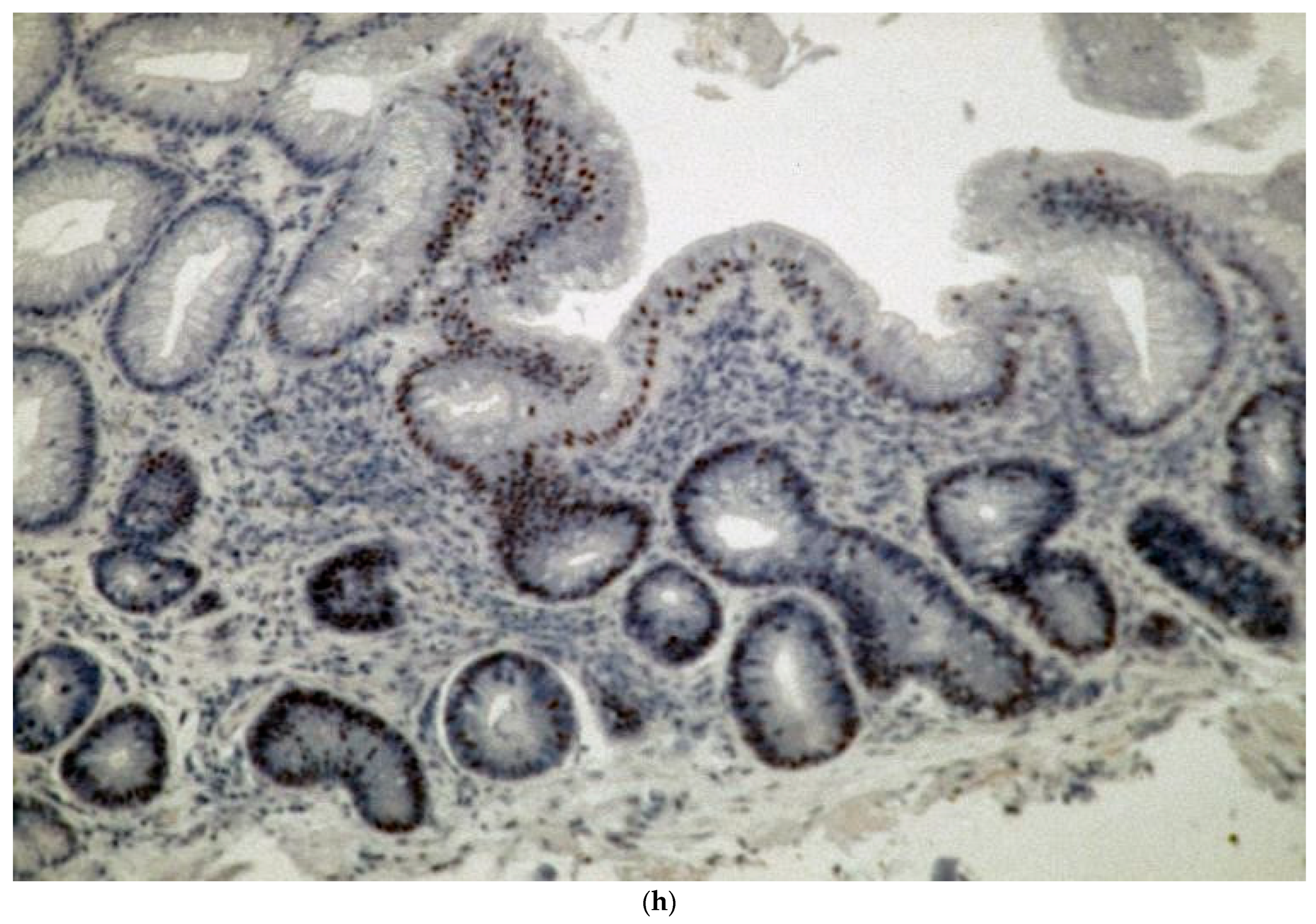 Biomolecules 14 01182 g002f