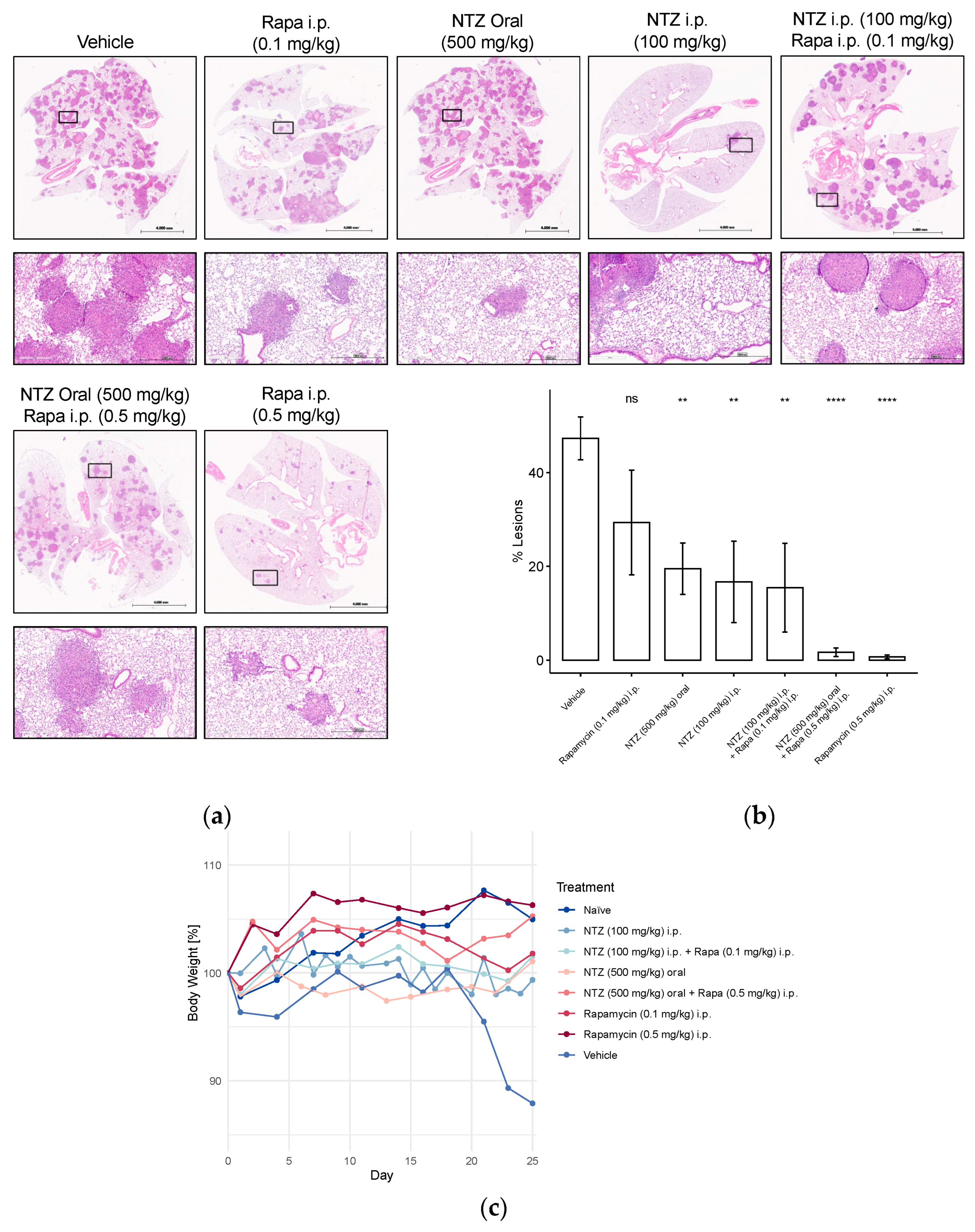 高い信頼 厚い信頼 Potential for Nitazoxanide Repurposing Treatment Rare of ウエイトトレーニング