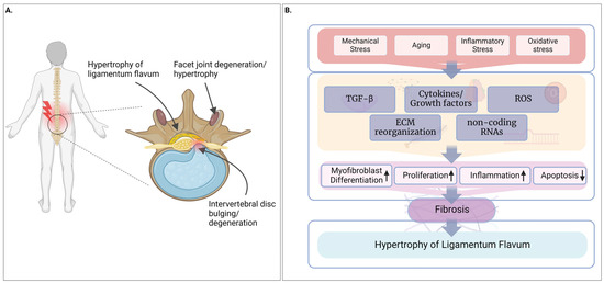 Cellular and Molecular Mechanisms of Hypertrophy of