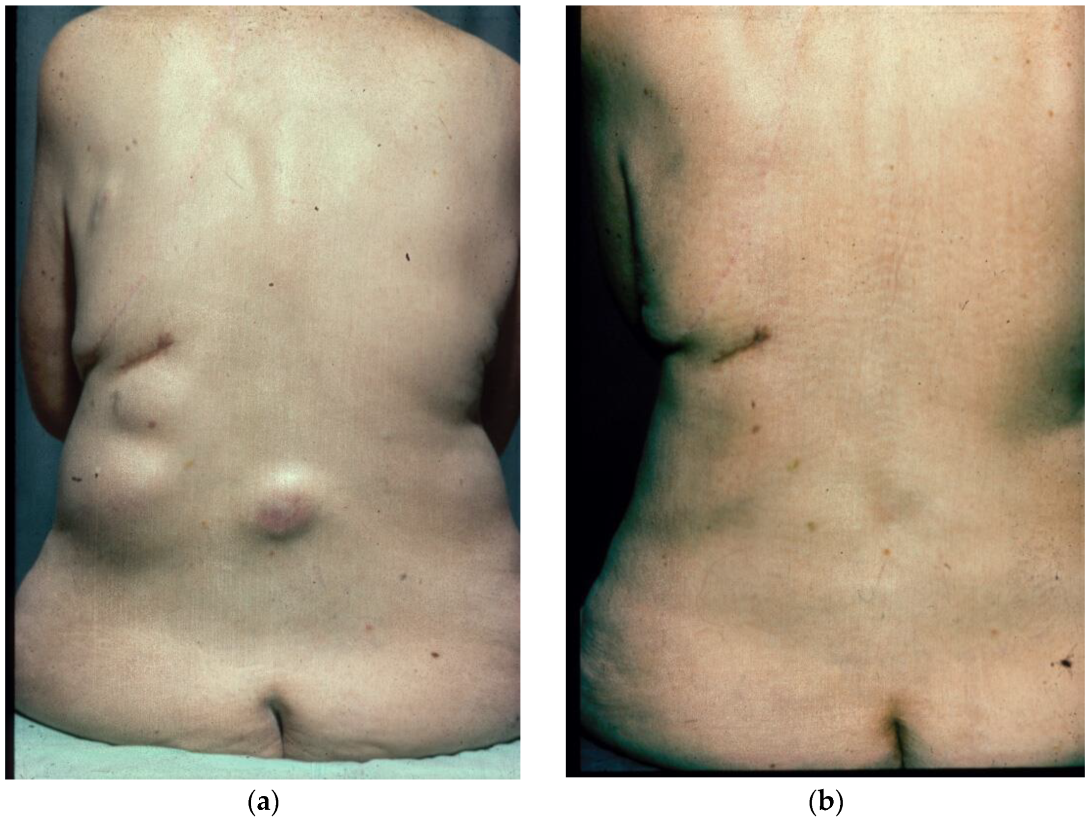 Biomolecules 14 01383 g001