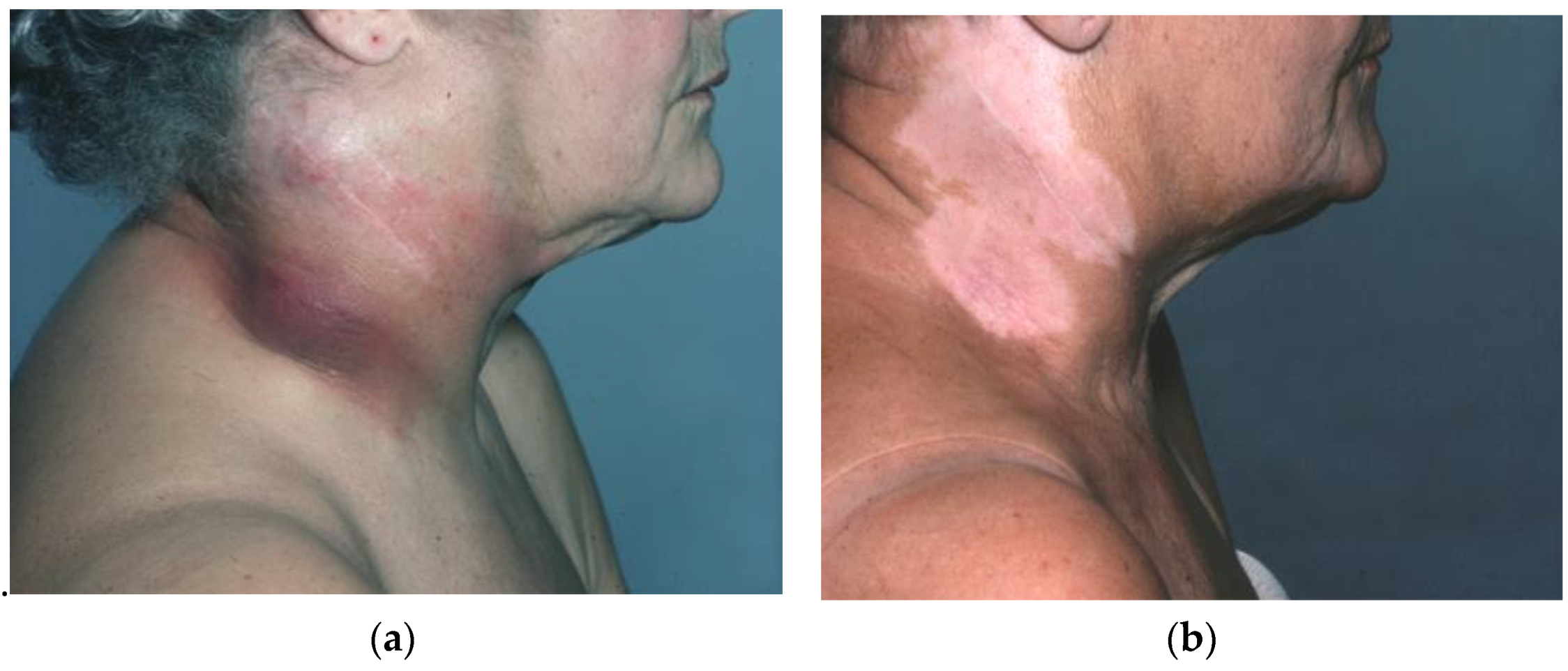 Biomolecules 14 01383 g002