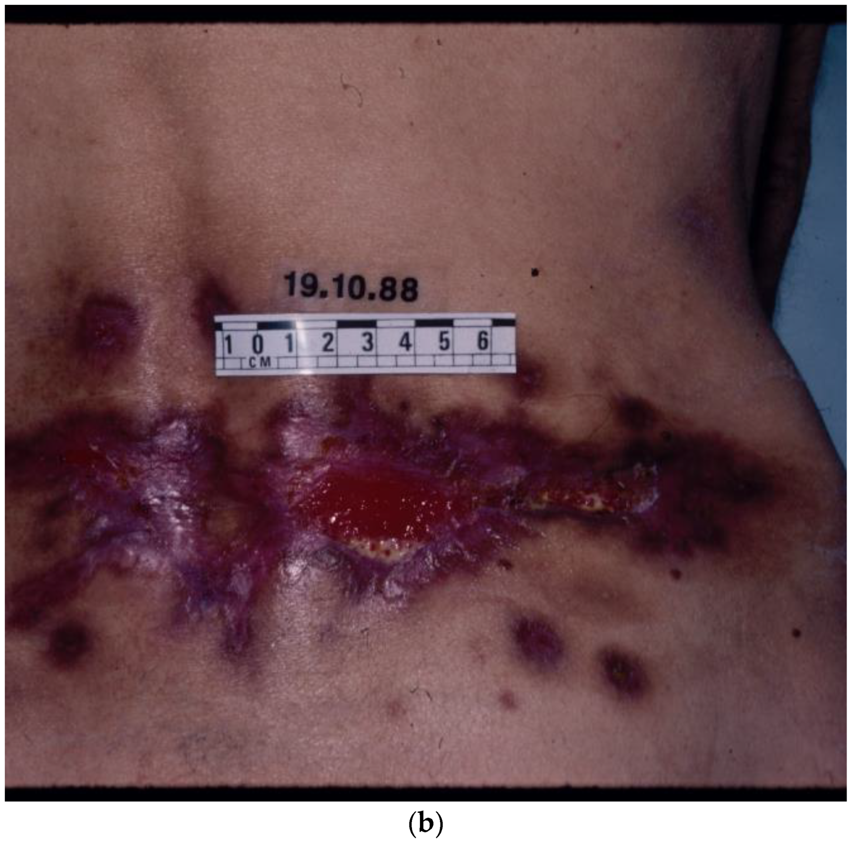 Biomolecules 14 01383 g003b