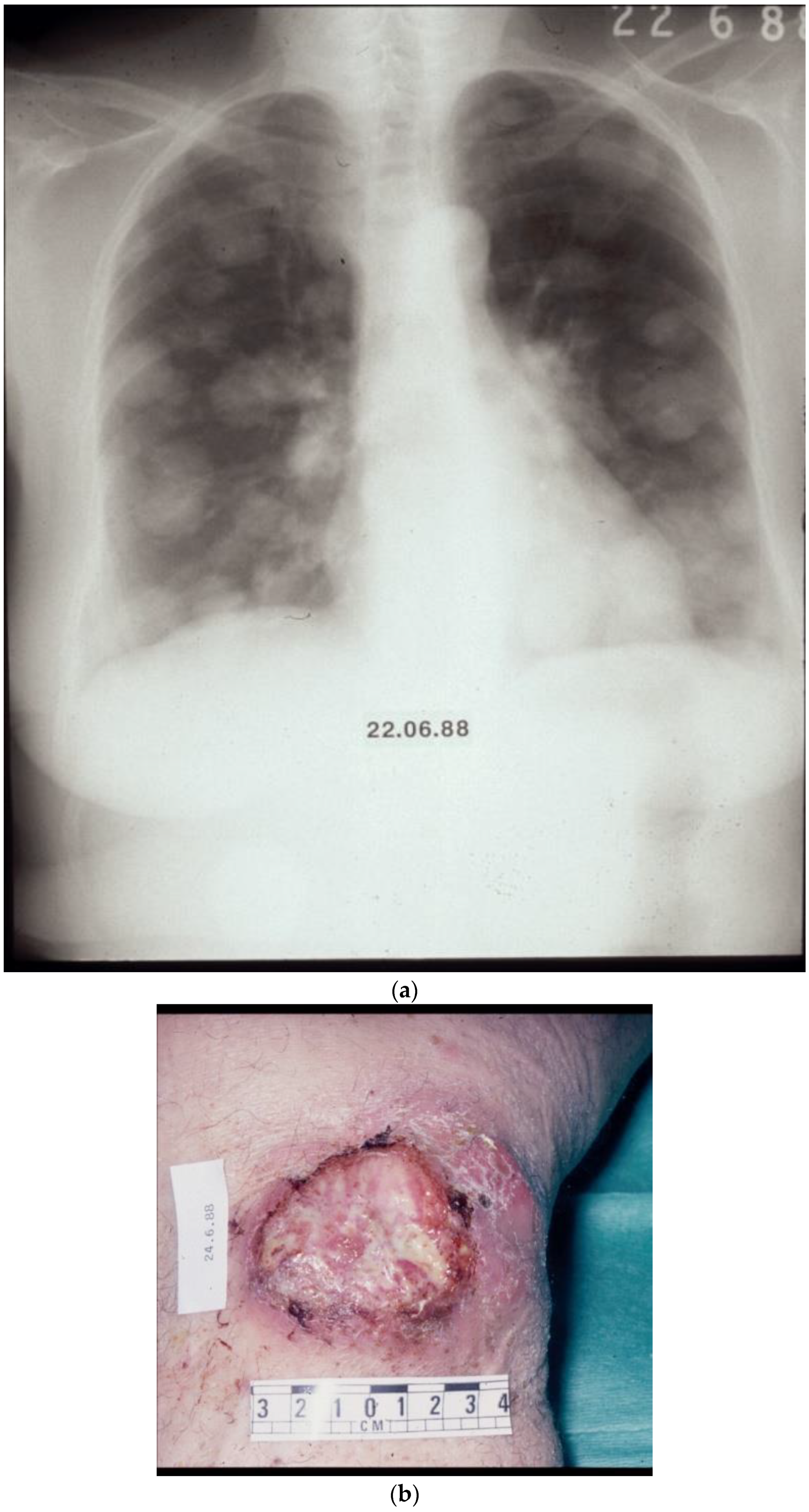 Biomolecules 14 01383 g004a