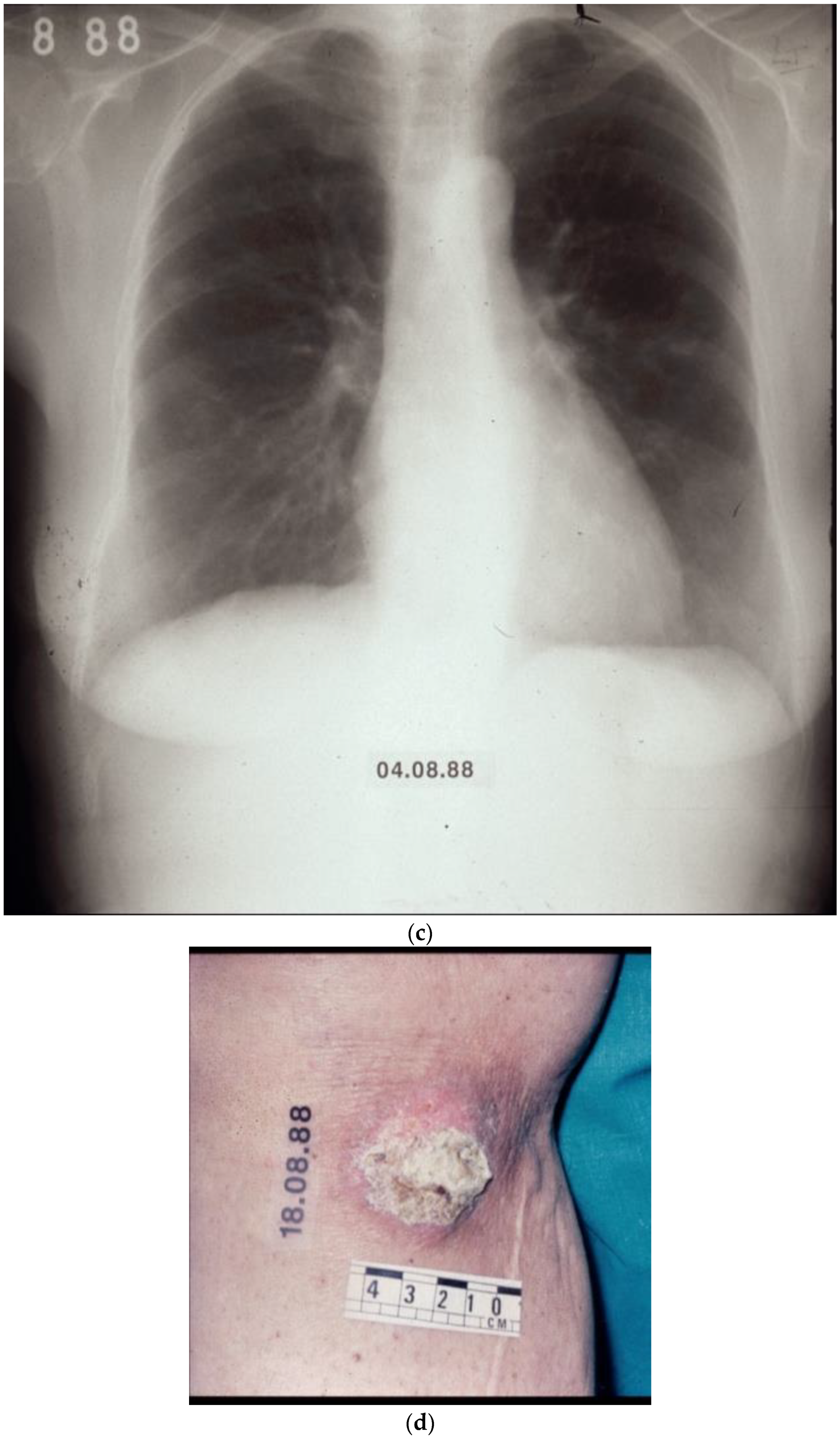 Biomolecules 14 01383 g004b