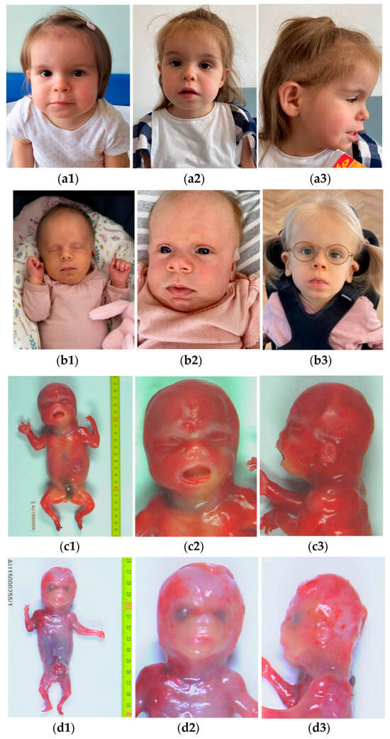 P3 Infant, Case of 9