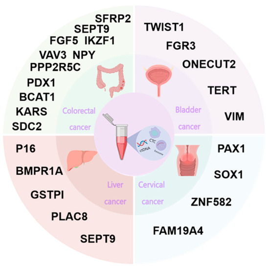 Research Progress of Liquid Biopsy Based on DNA Methylation