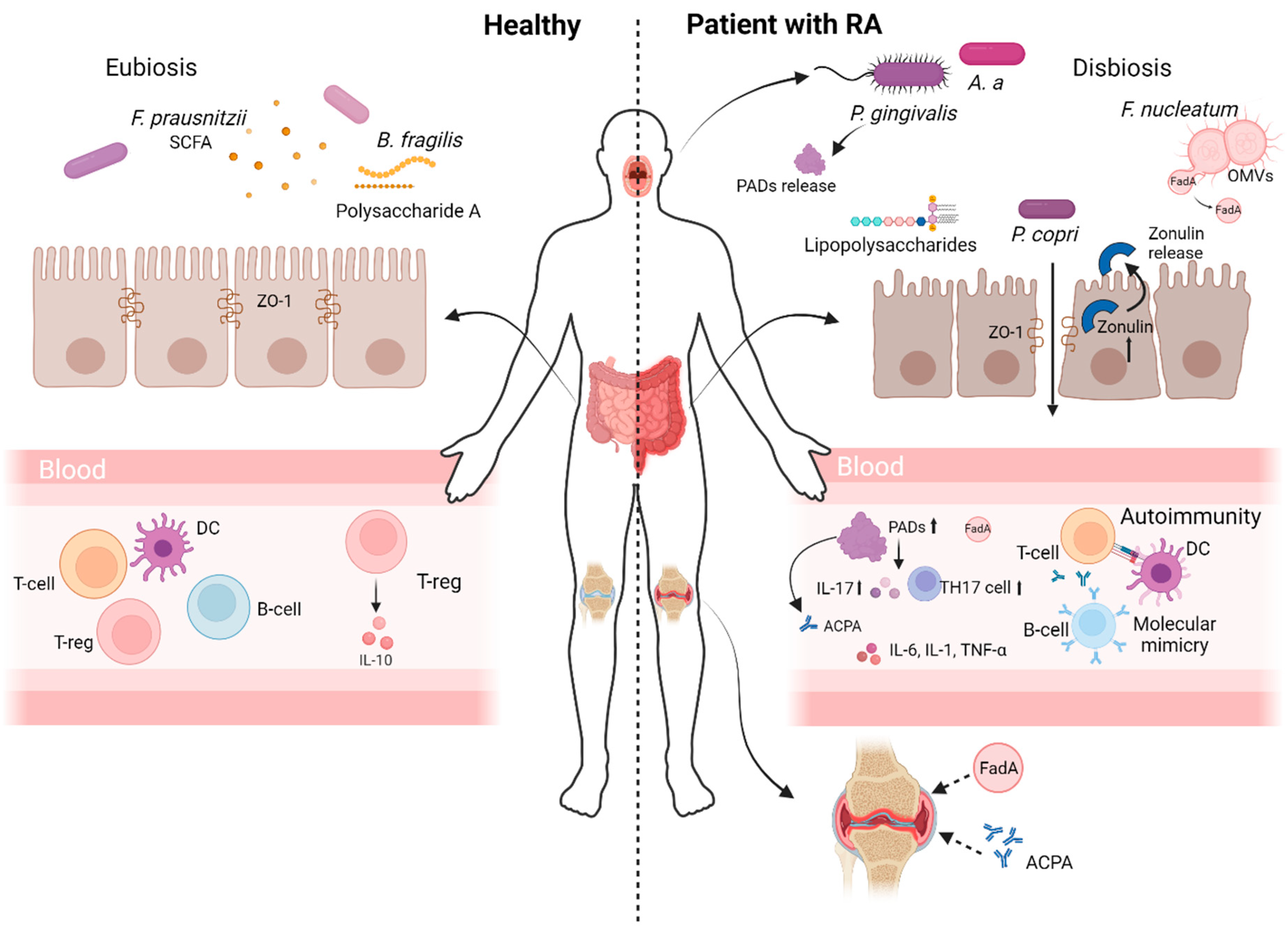 Gut Microbiota Modulation: A Novel Strategy for Rheumatoid