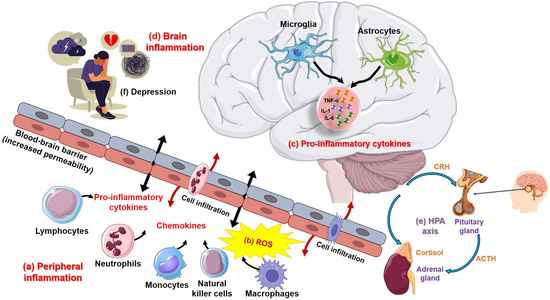 Neuroinflammation—A Crucial Factor in the Pathophysiology of