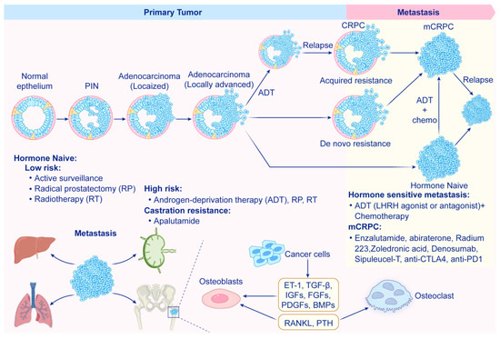 Role of Tumor Microenvironment in Prostate Cancer