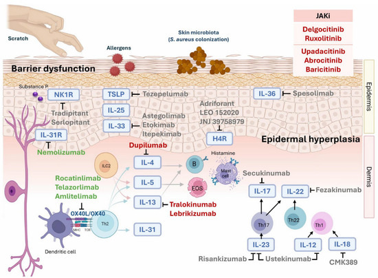 Advancing Therapeutic Strategies in Atopic Dermatitis