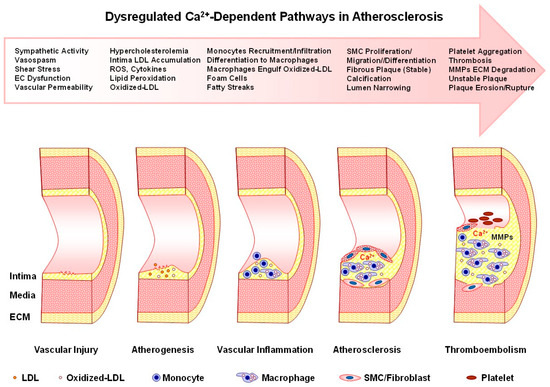 Calcium Signaling Dynamics in Vascular Cells and Their Dysregulation in ...
