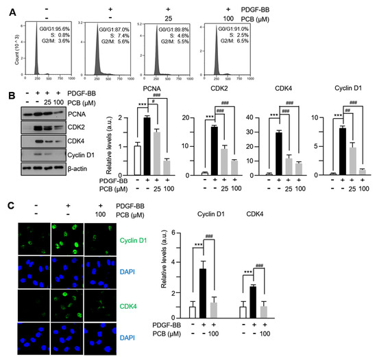 Pinocembrin Downregulates Vascular Smooth Muscle Cells