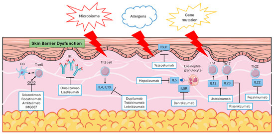 Understanding Atopic Dermatitis: Pathophysiology and Management